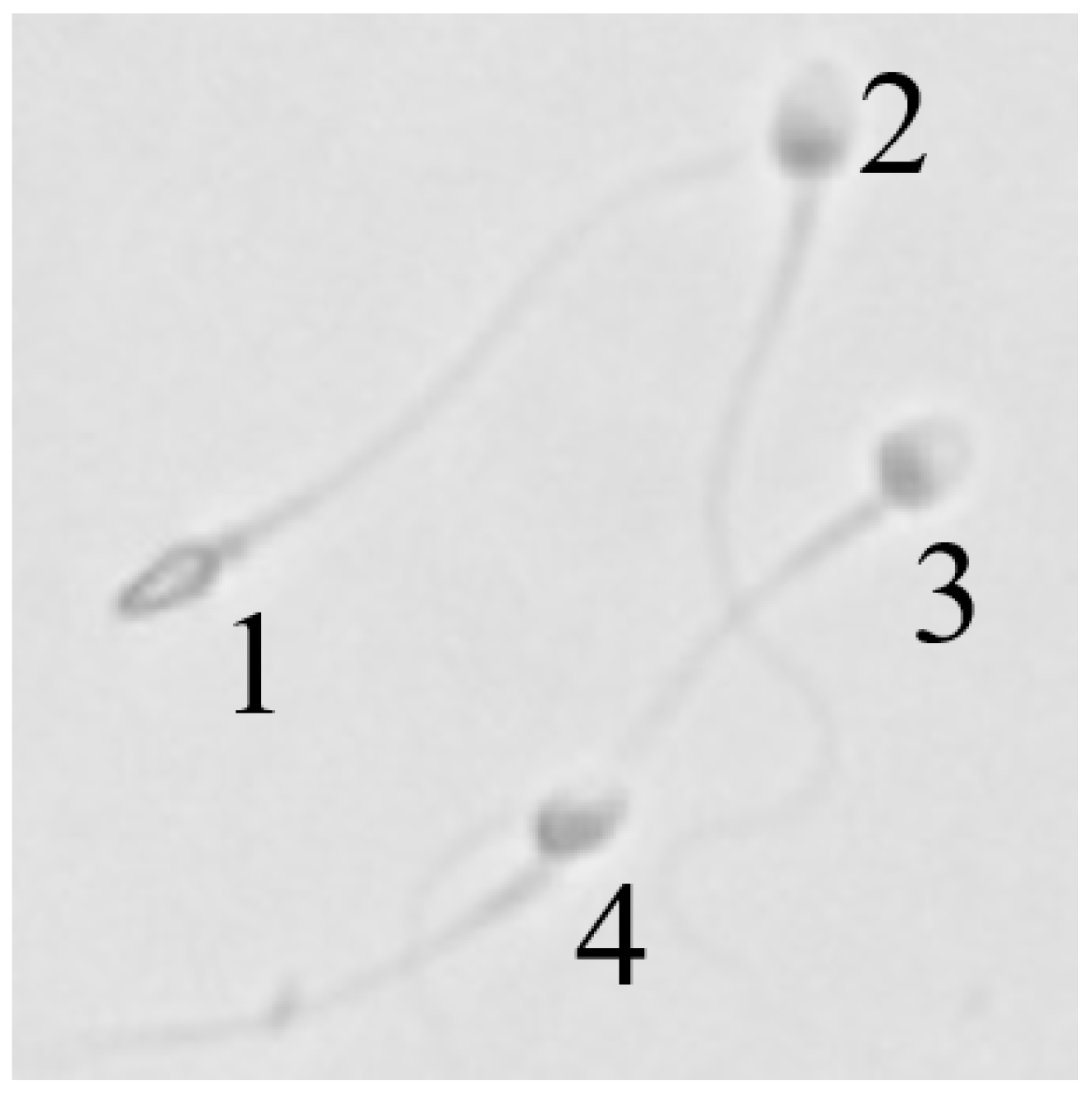 Sensors 25 00592 i001