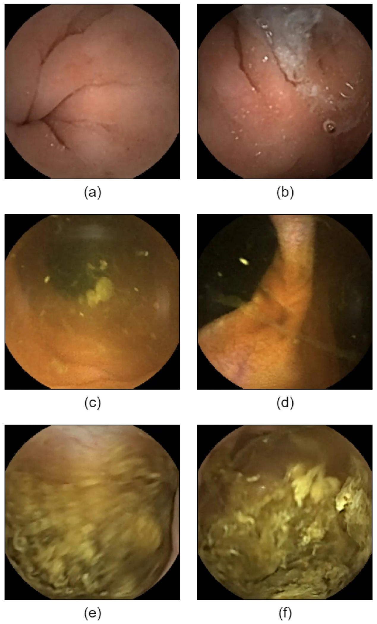 Sensors 25 00746 g005