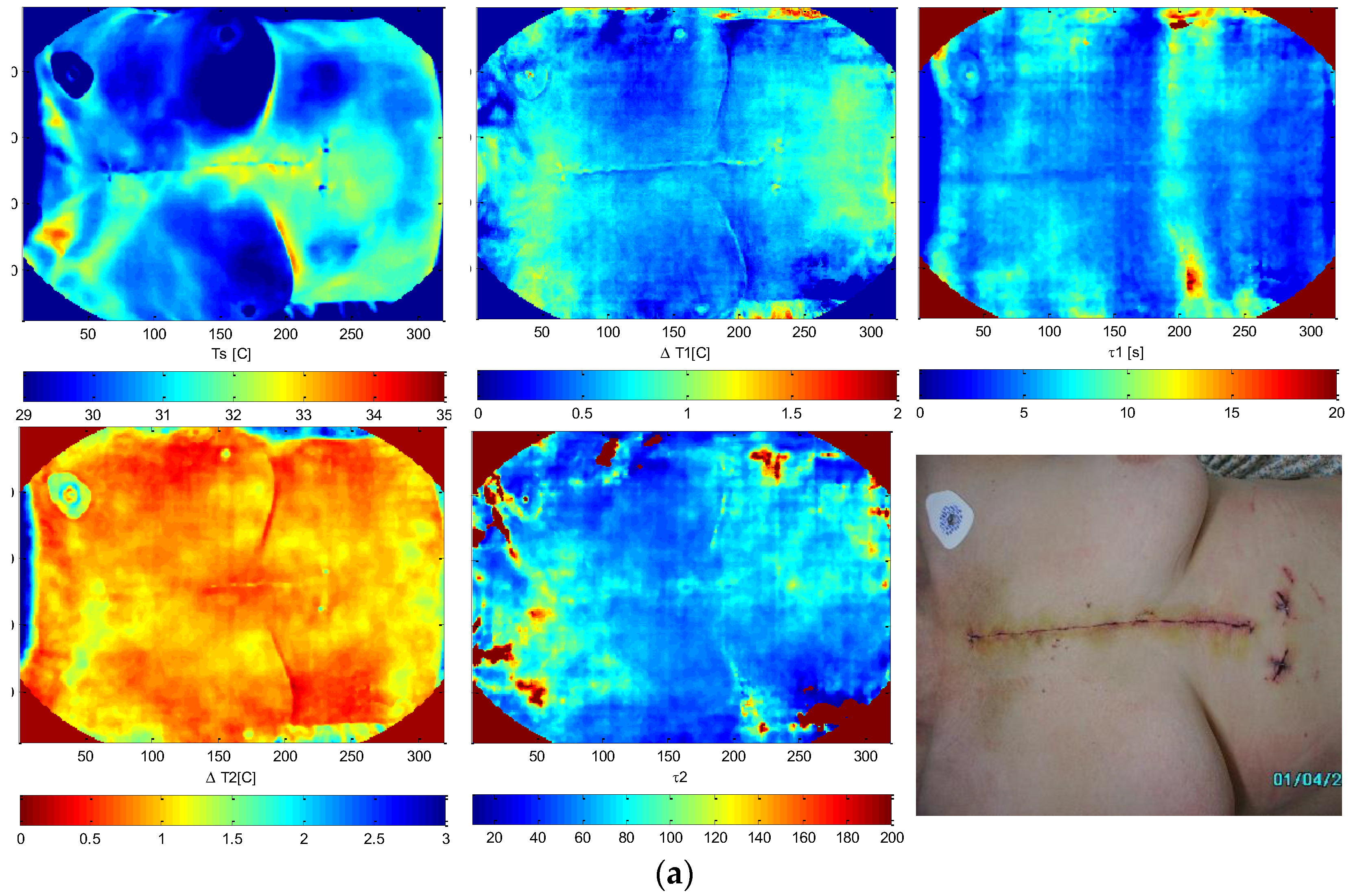 Sensors 25 00891 g006a Sensors 25 00891 g006a