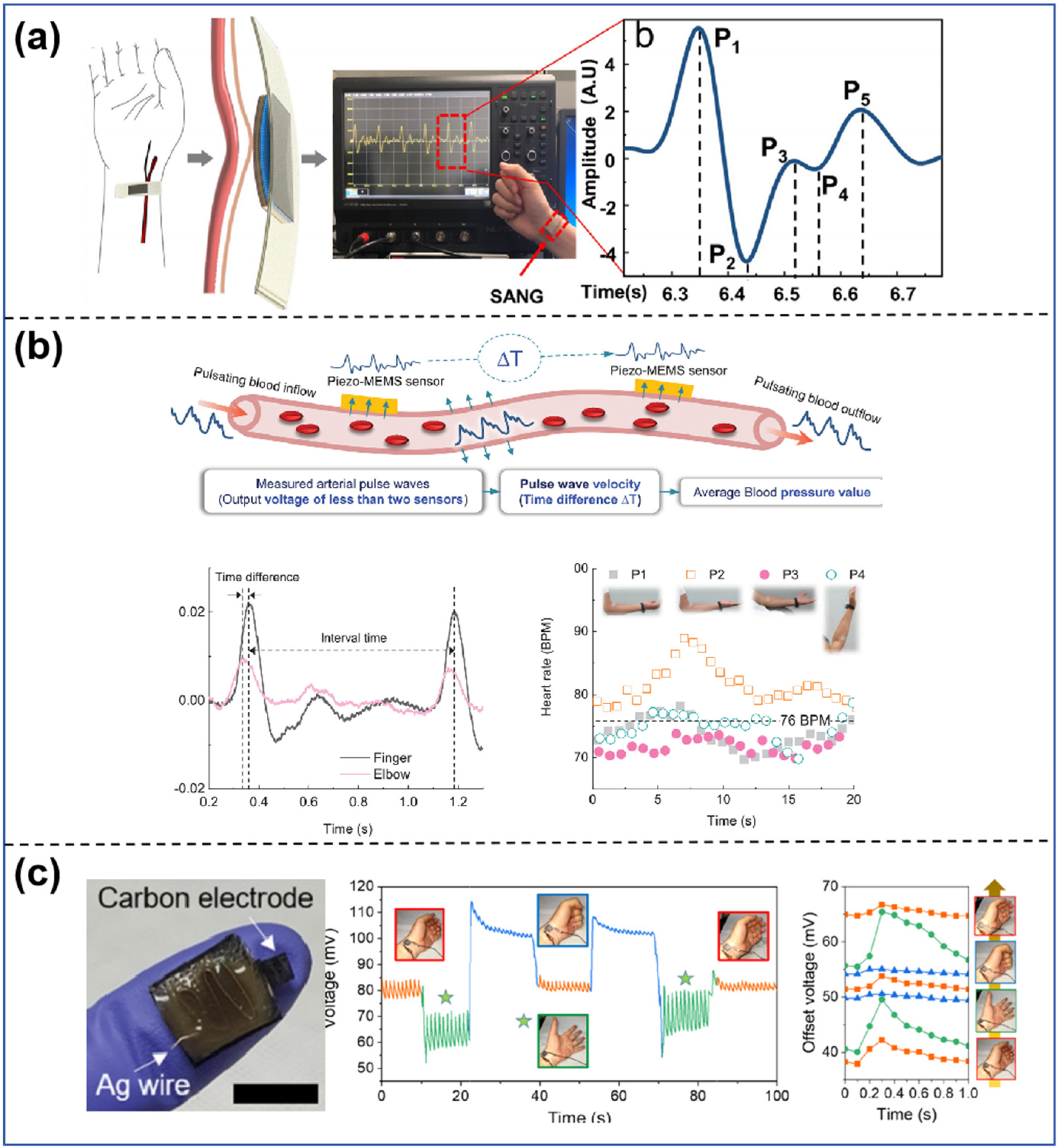 Sensors 25 00964 g006