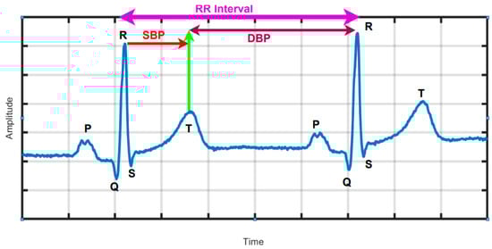 Sensors 25 01180 g001