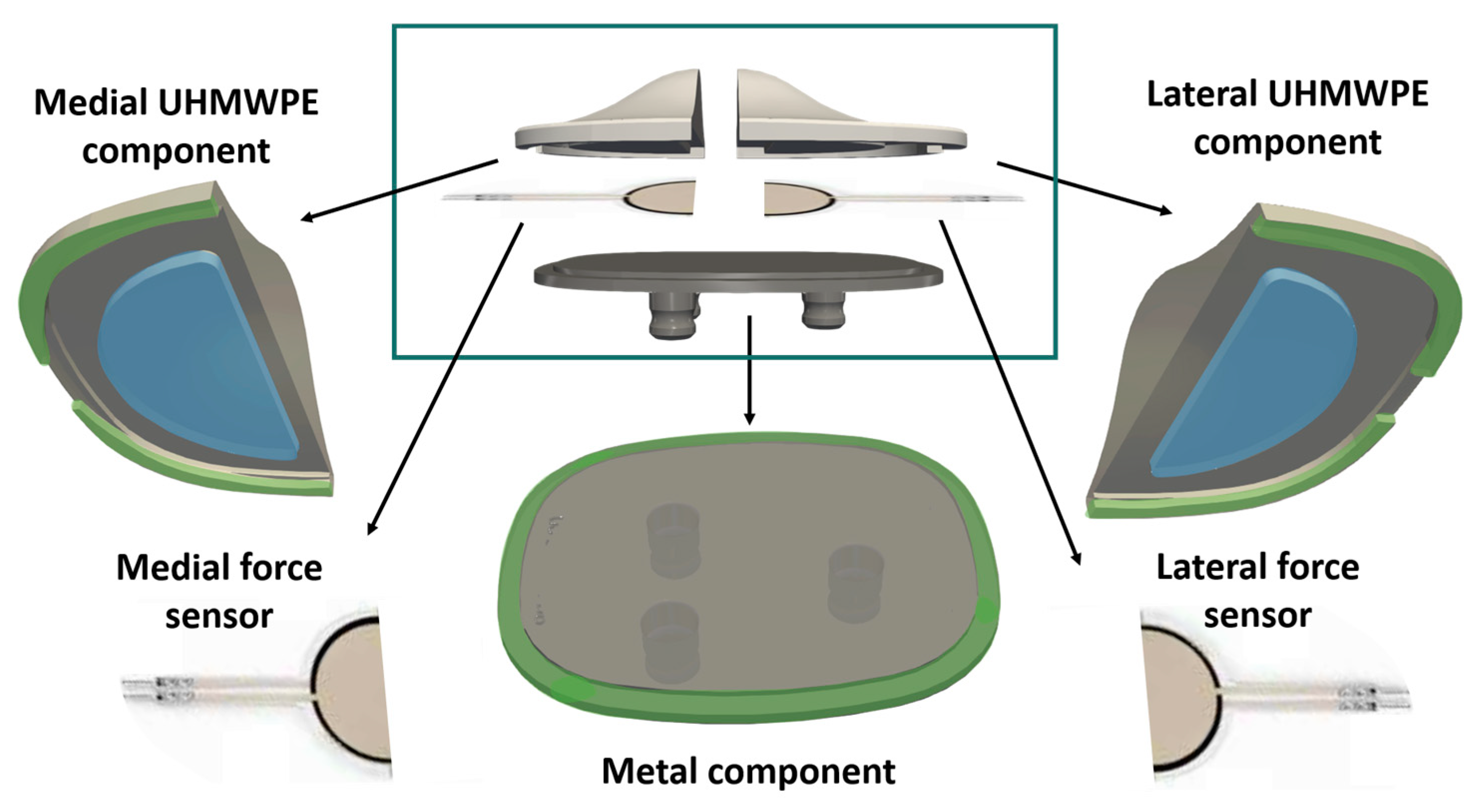 Sensors 25 01226 g004