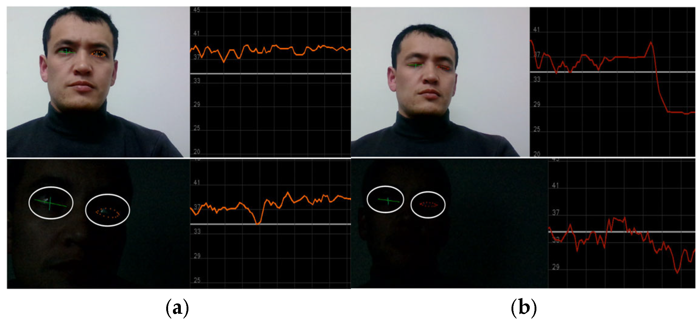 Sensors 25 01472 g007