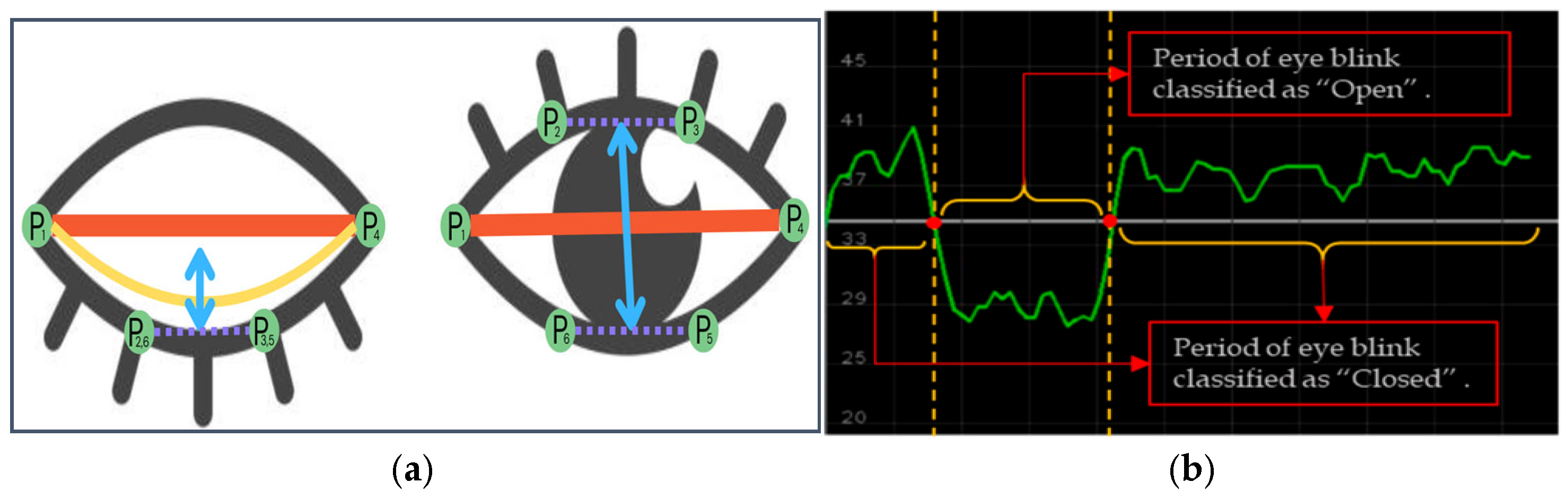 Sensors 25 01472 g008