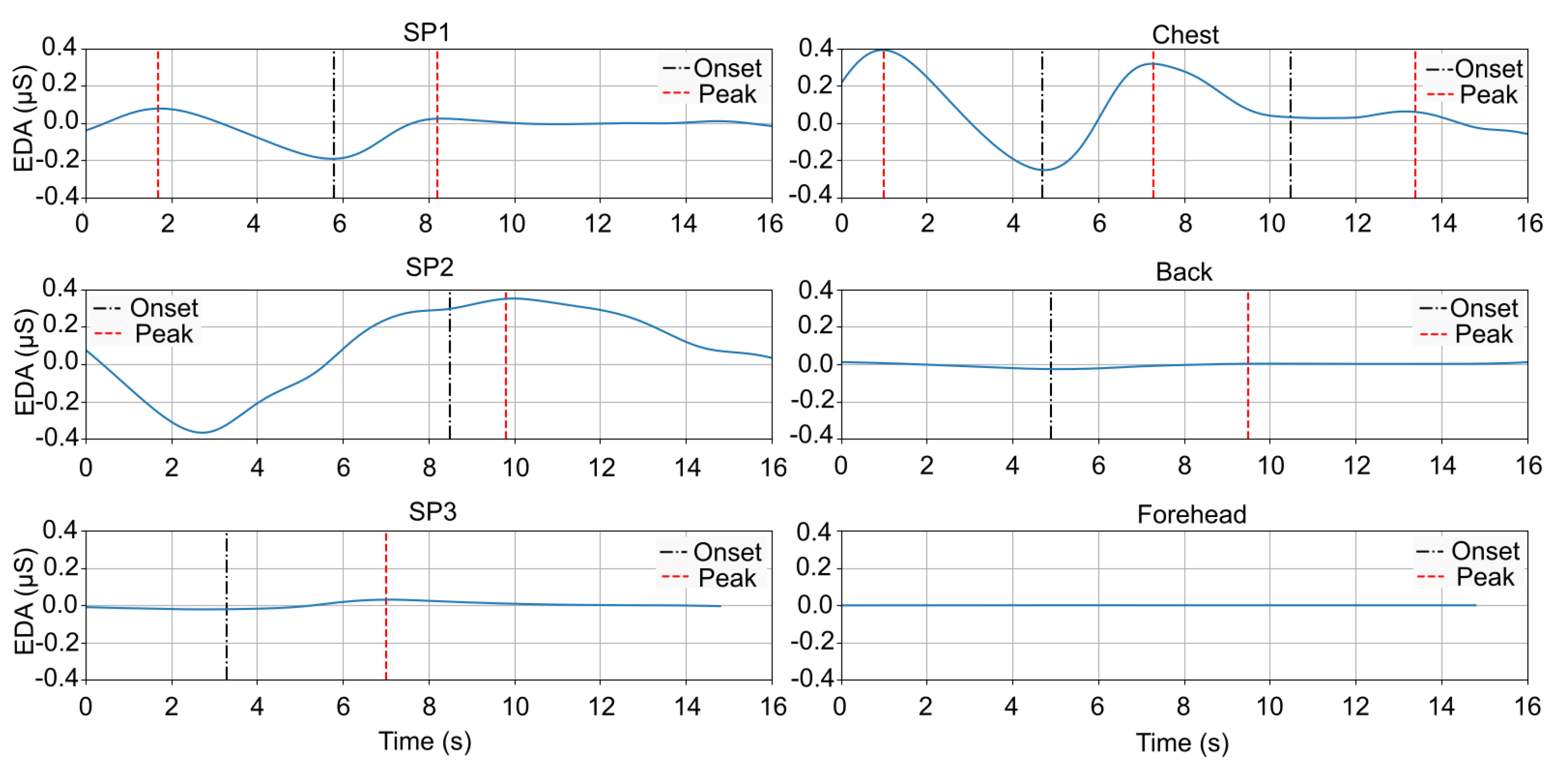 Sensors 25 01762 g005