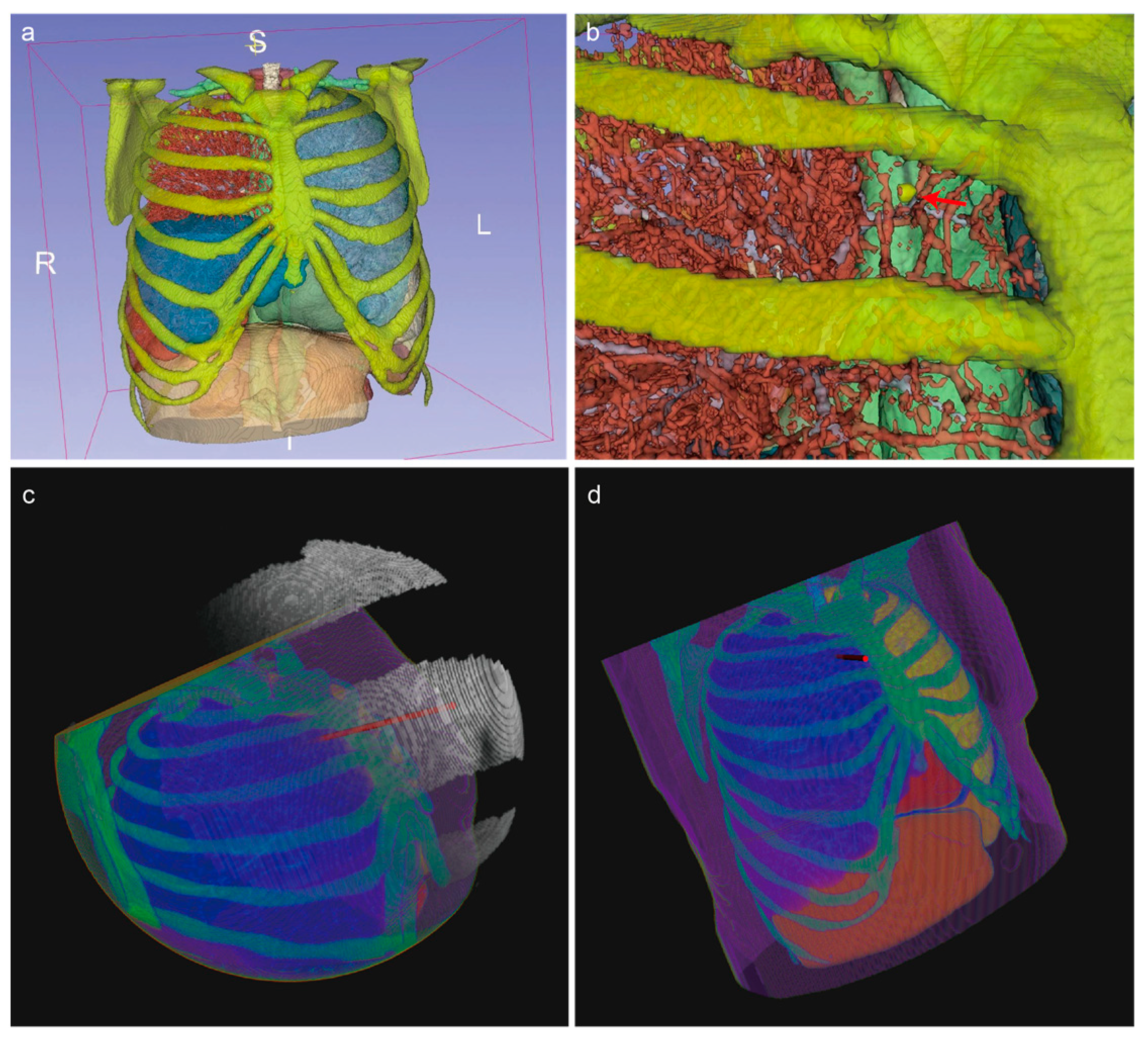 Sensors 25 02137 g006