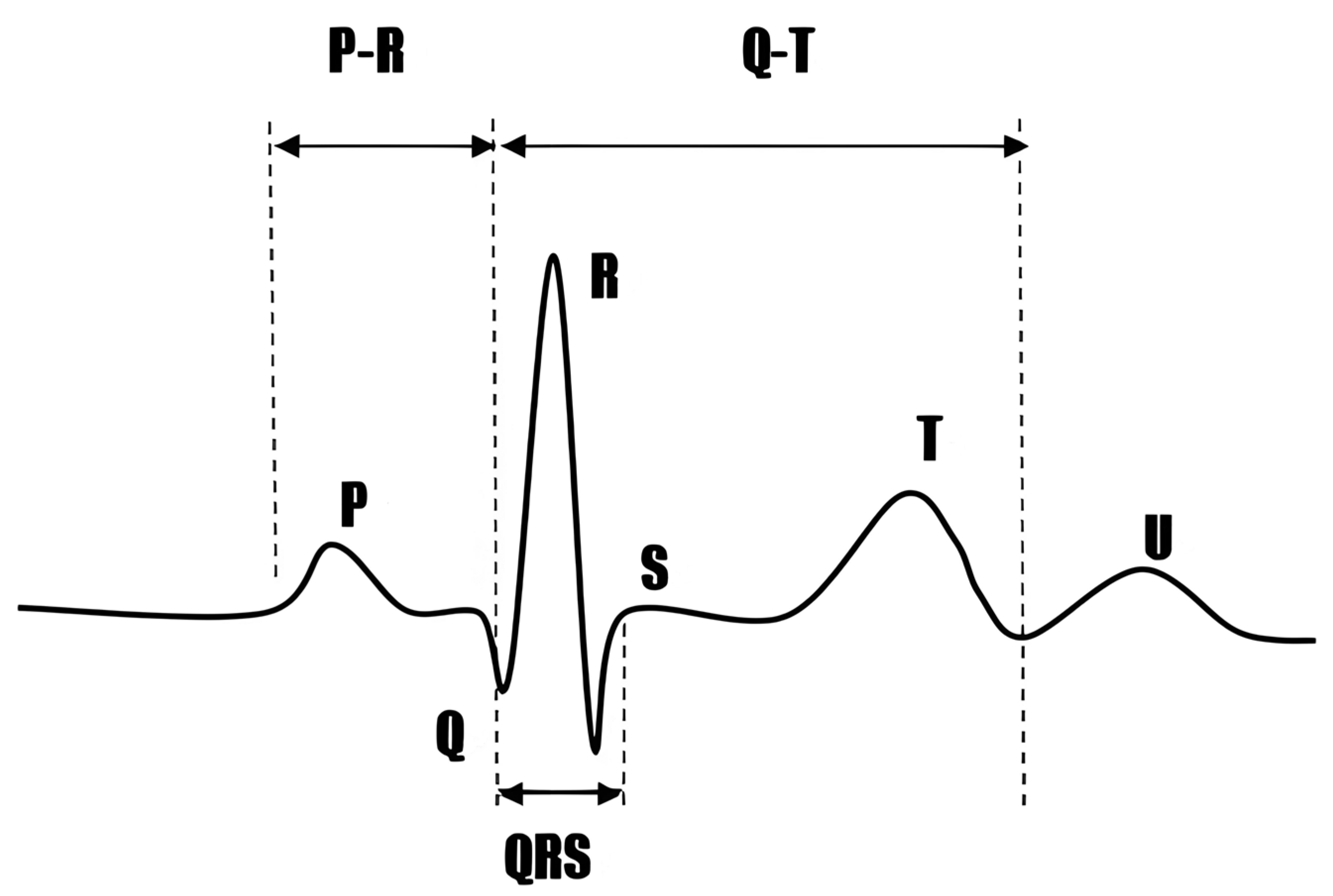 Sensors 25 02321 g004