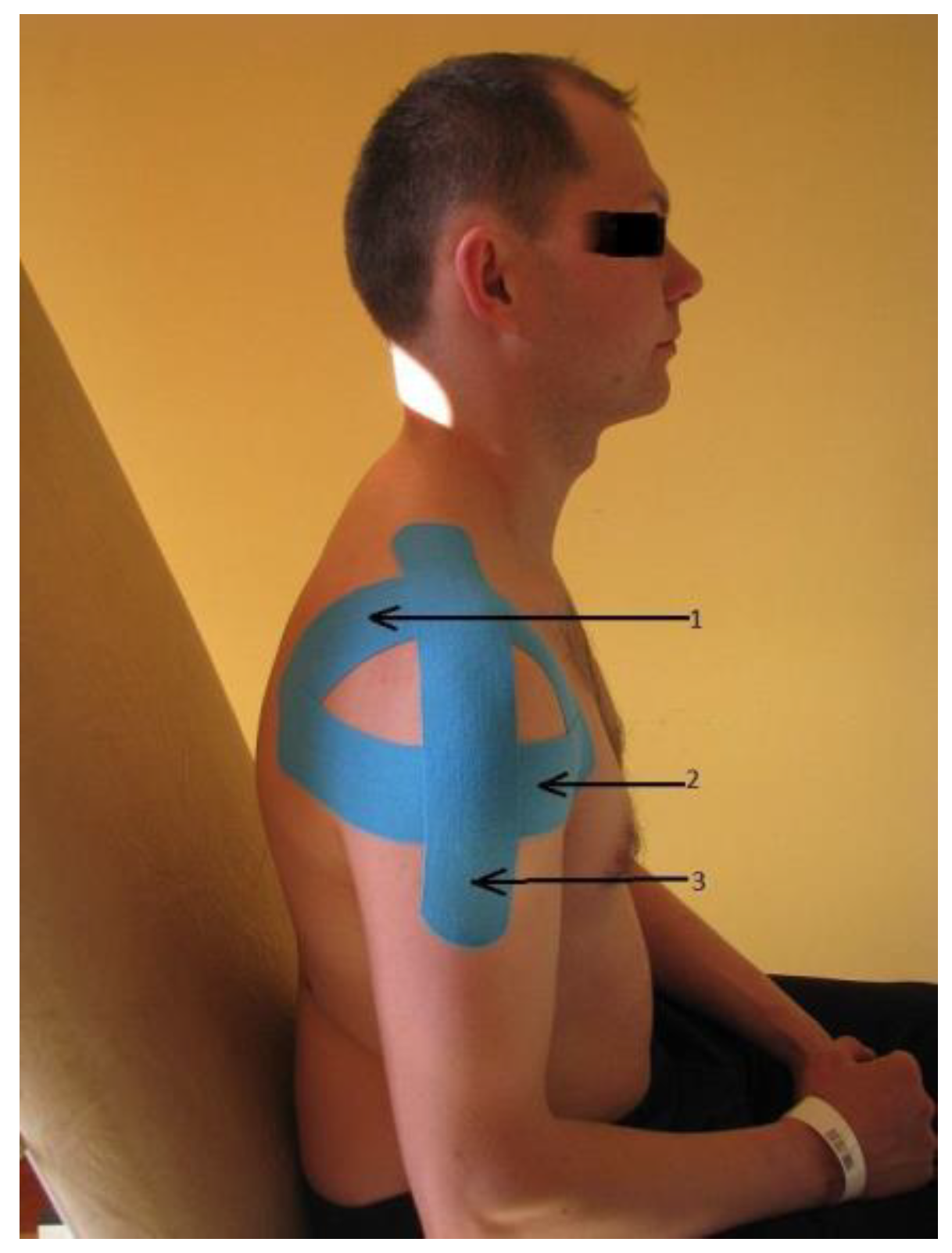 Sensors 25 02326 g001 Sensors 25 02326 g001
