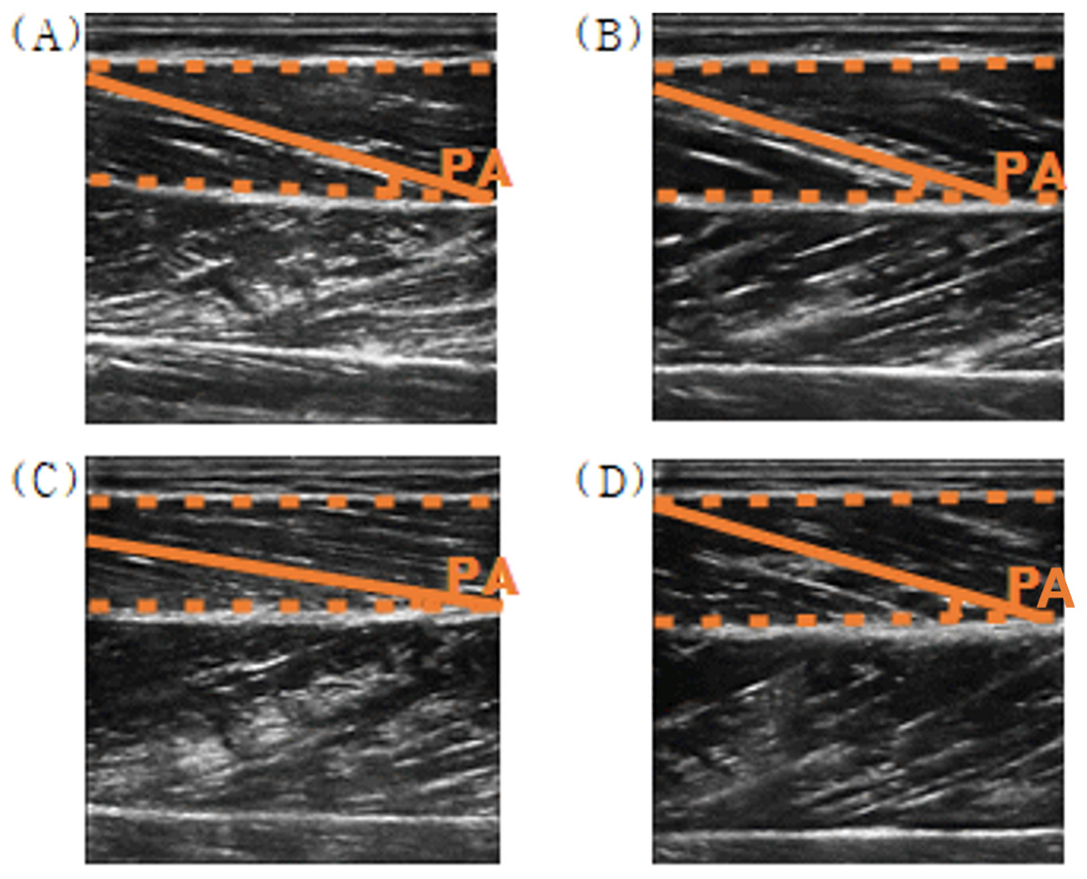Sensors 25 02455 g011