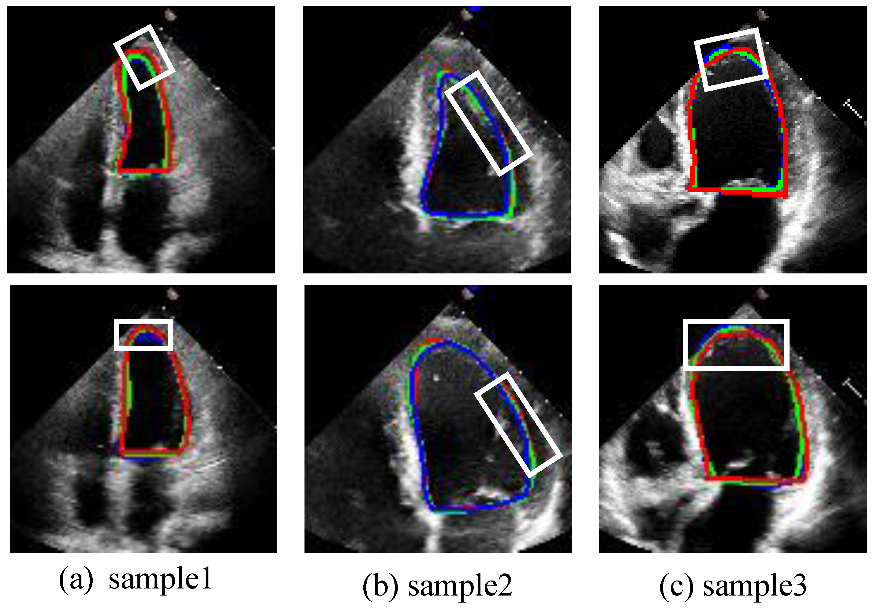 Sensors 25 02704 g006