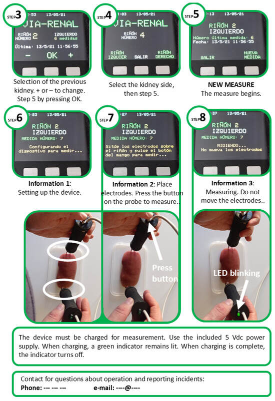 Sensors 25 02871 g0a3