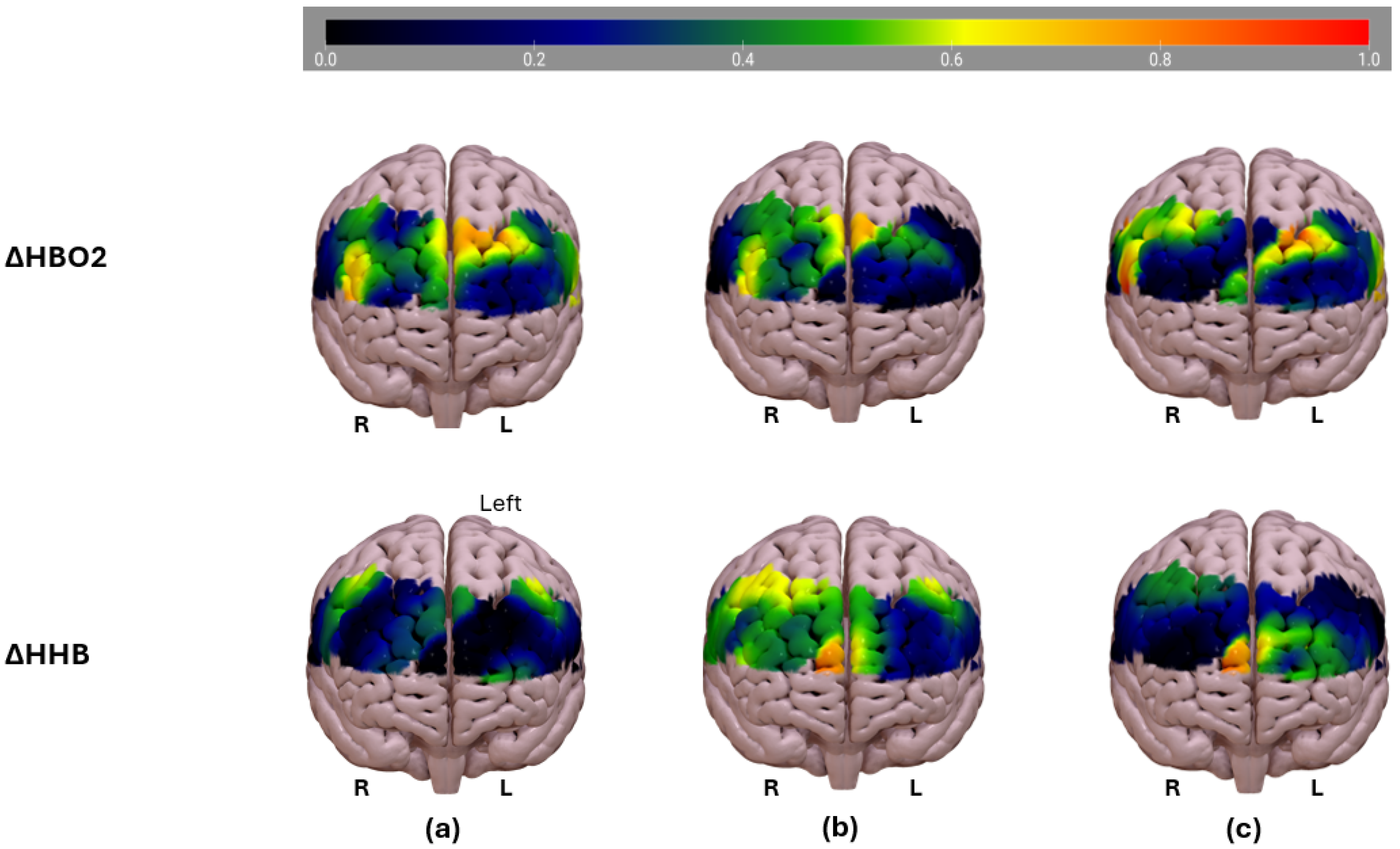 Sensors 25 02965 g005