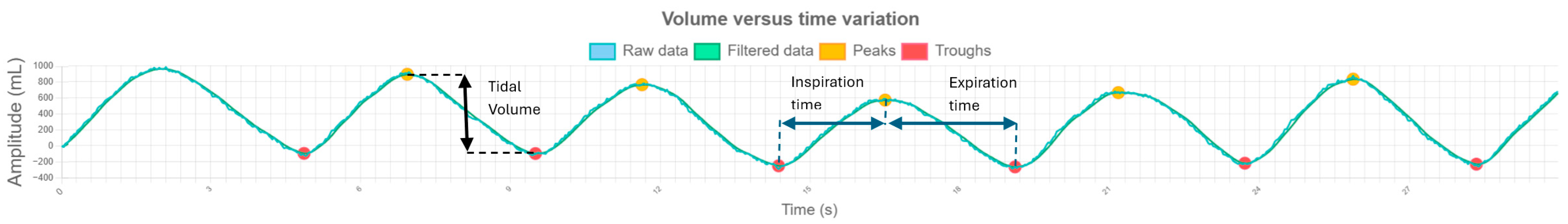 Sensors 25 03069 g003