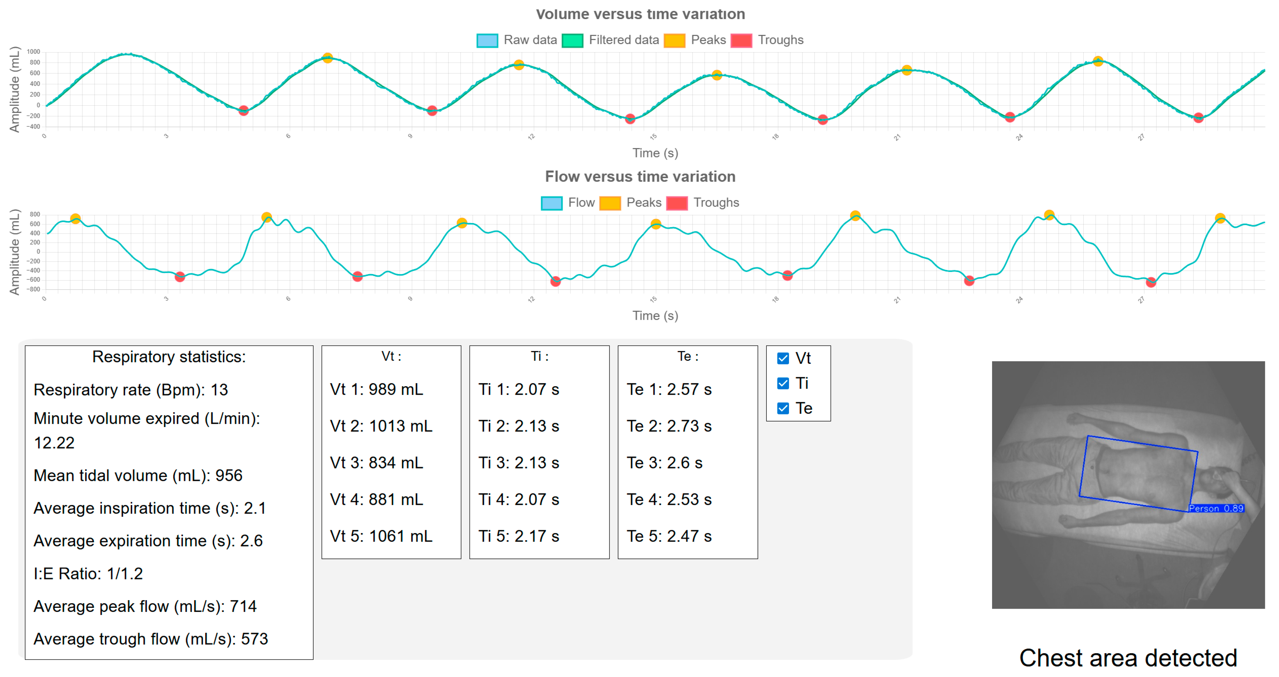 Sensors 25 03069 g004