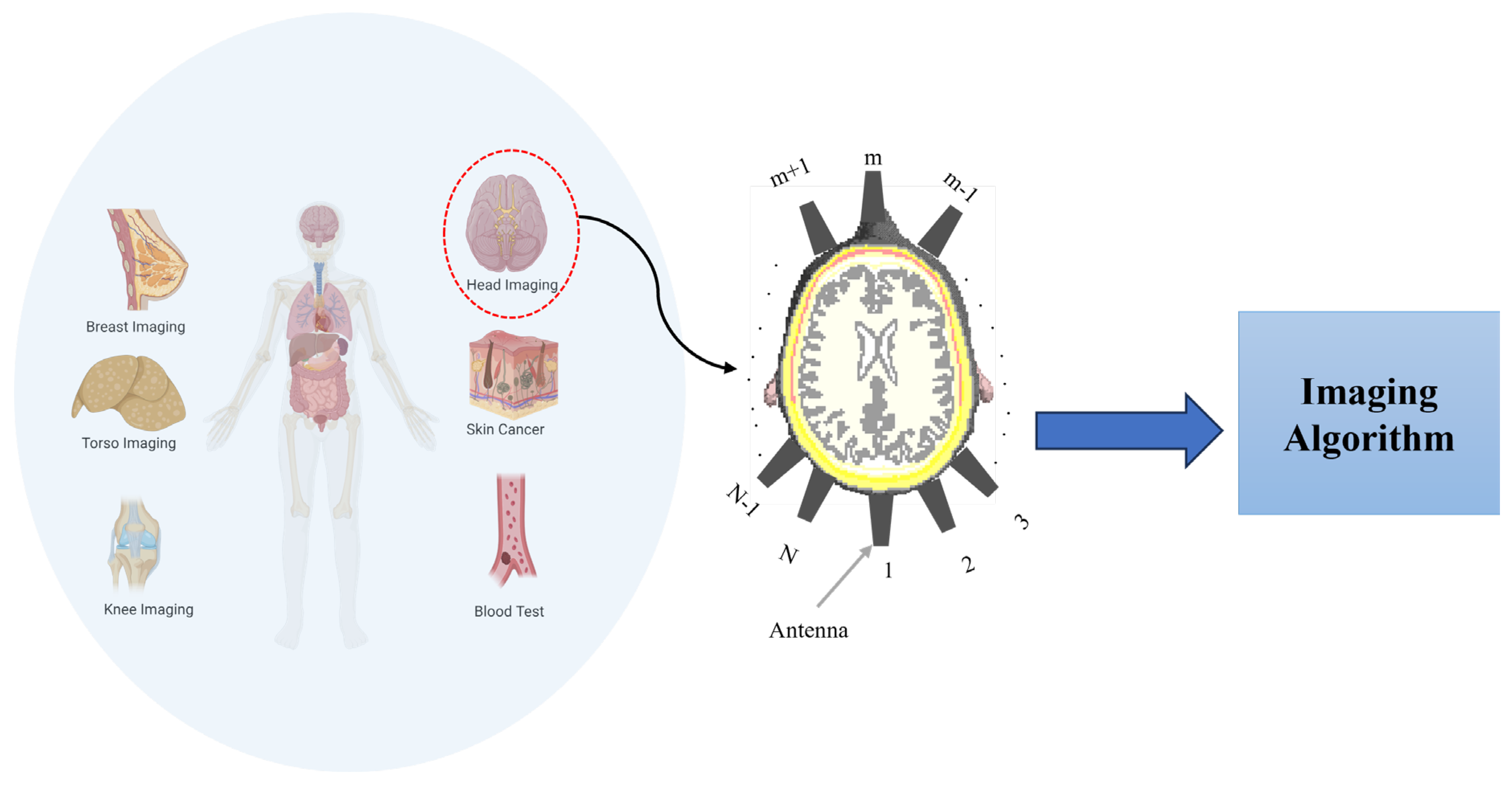 Sensors 25 03174 g001