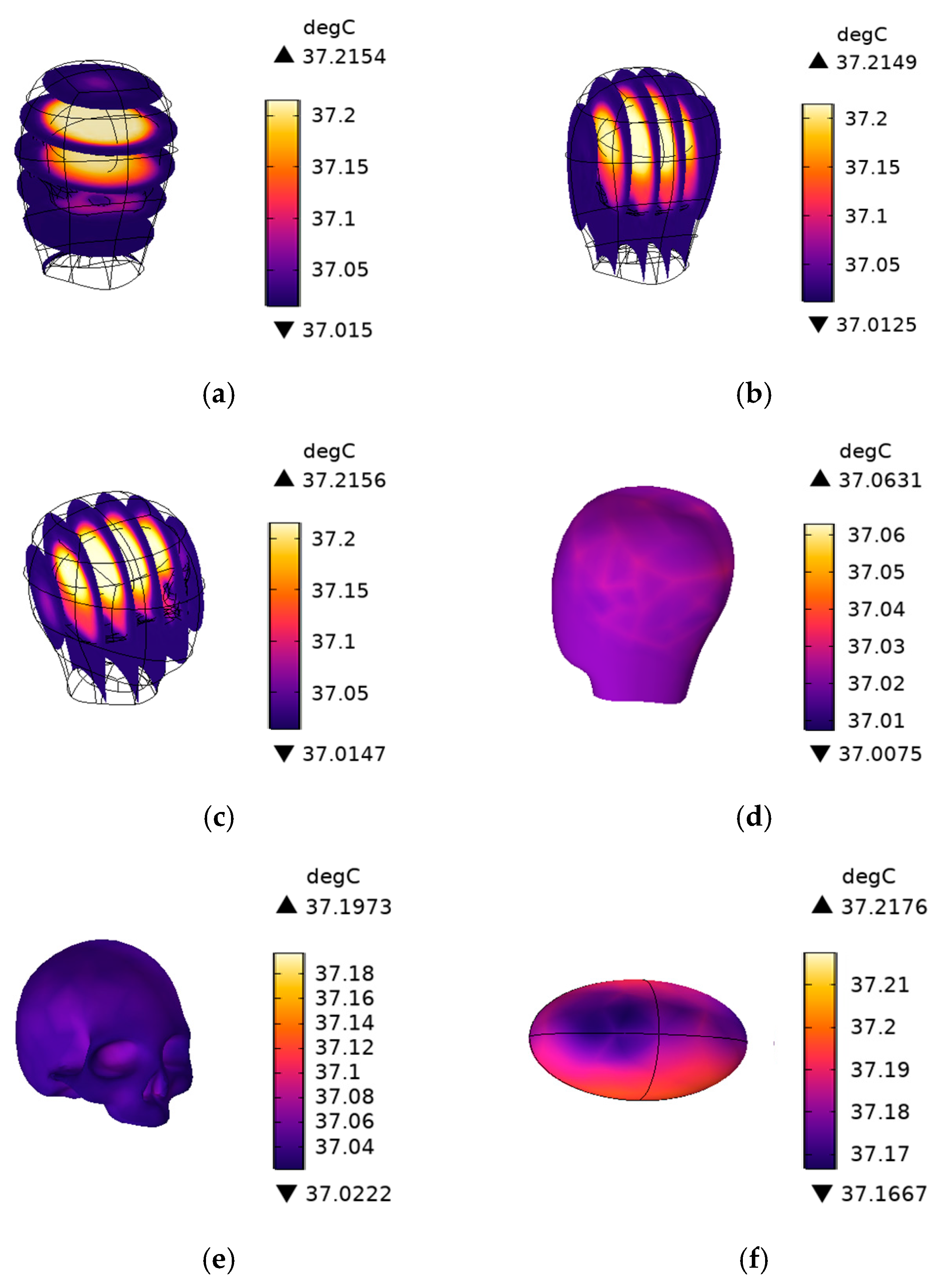 Sensors 25 03247 g014