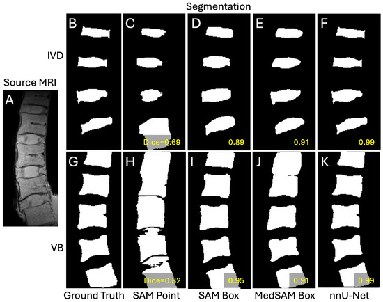 Sensors 25 03596 g004