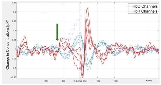 Sensors 25 03627 g0a1