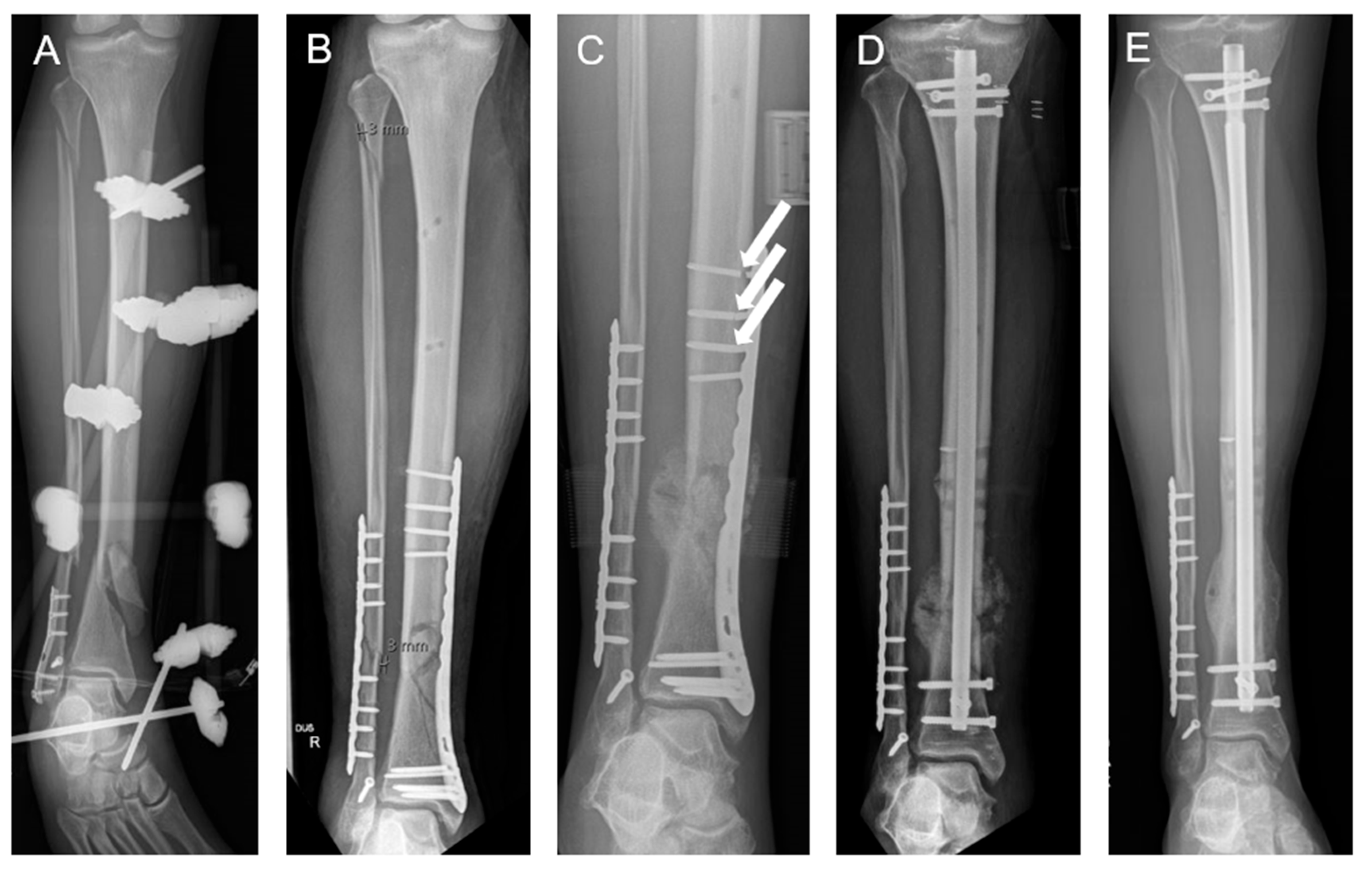 Sensors 25 03853 g001