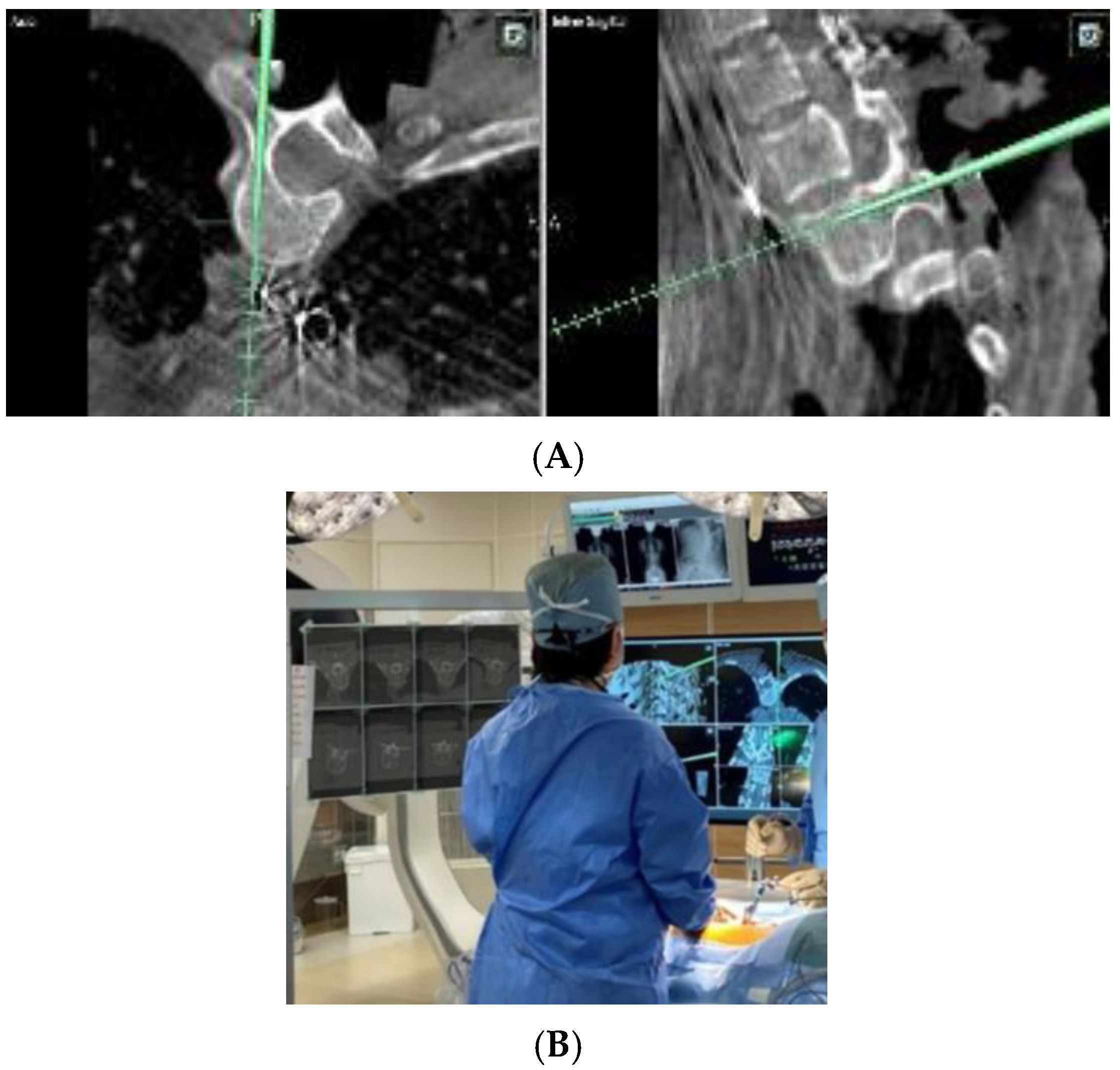 Sensors 25 03939 g001