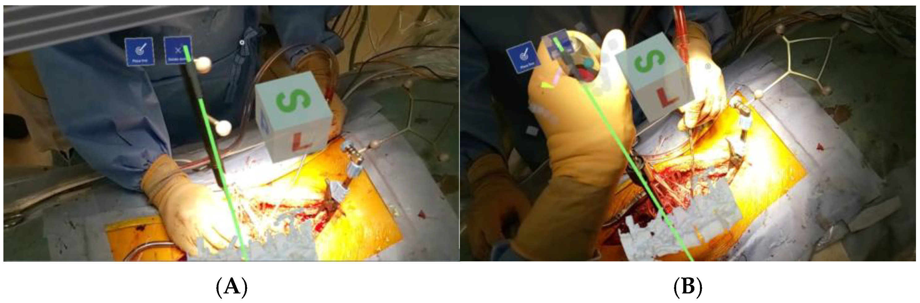 Sensors 25 03939 g003