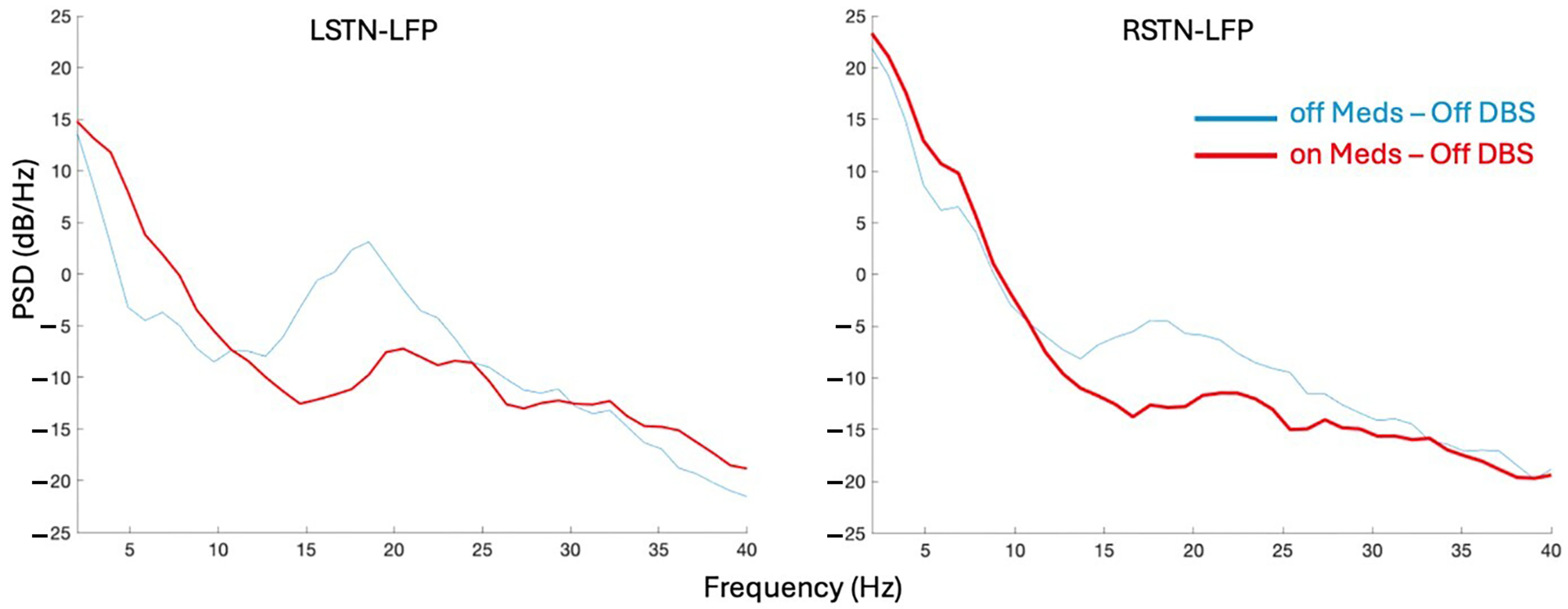 Sensors 25 04036 g004