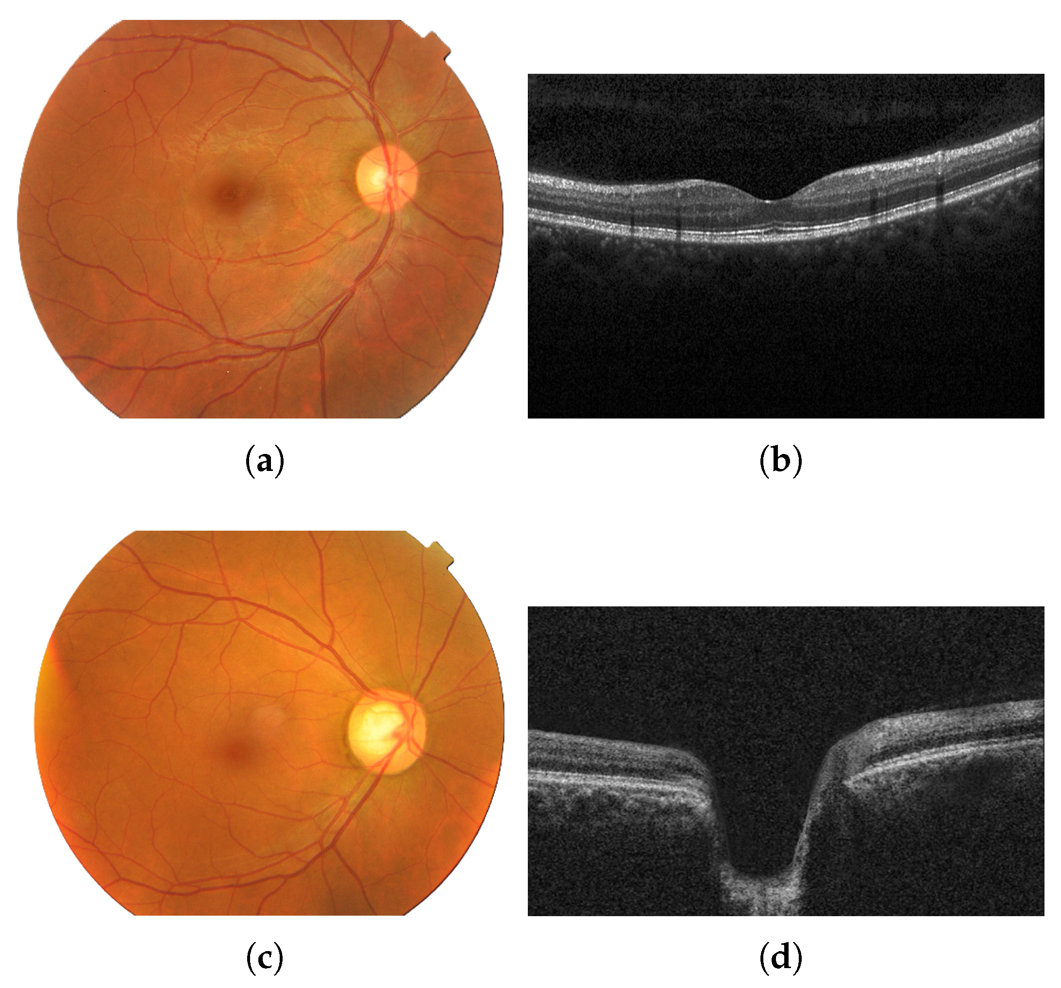 Sensors 25 04337 g001