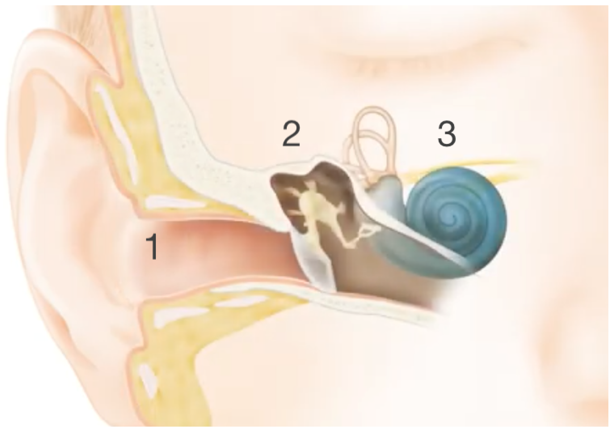 Sensors 25 04379 g001