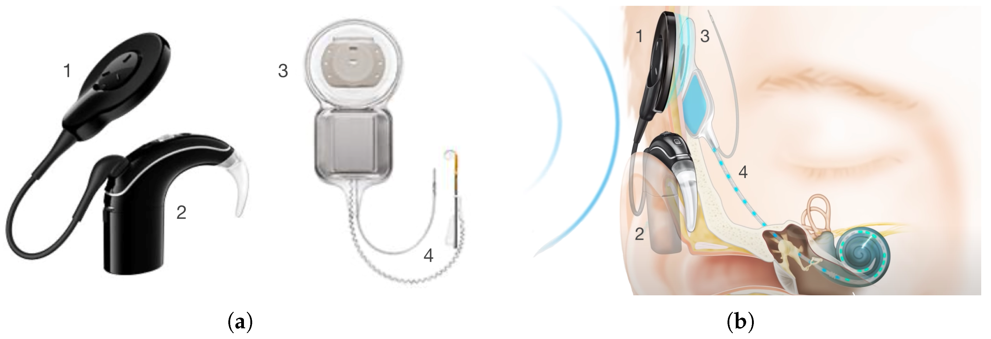 Sensors 25 04379 g002