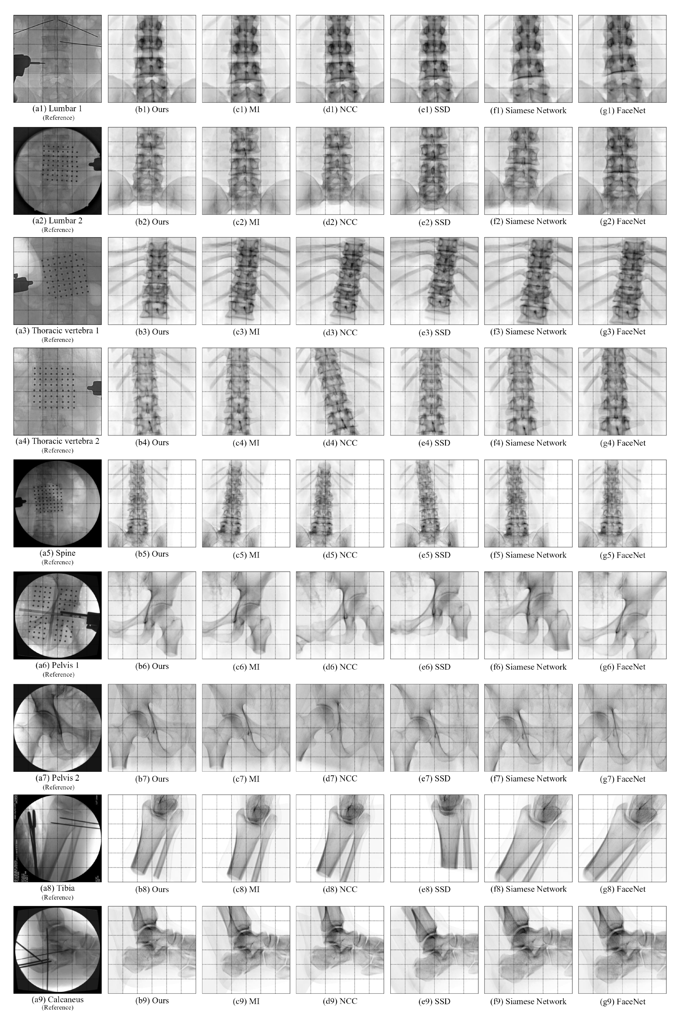 Sensors 25 04604 g008