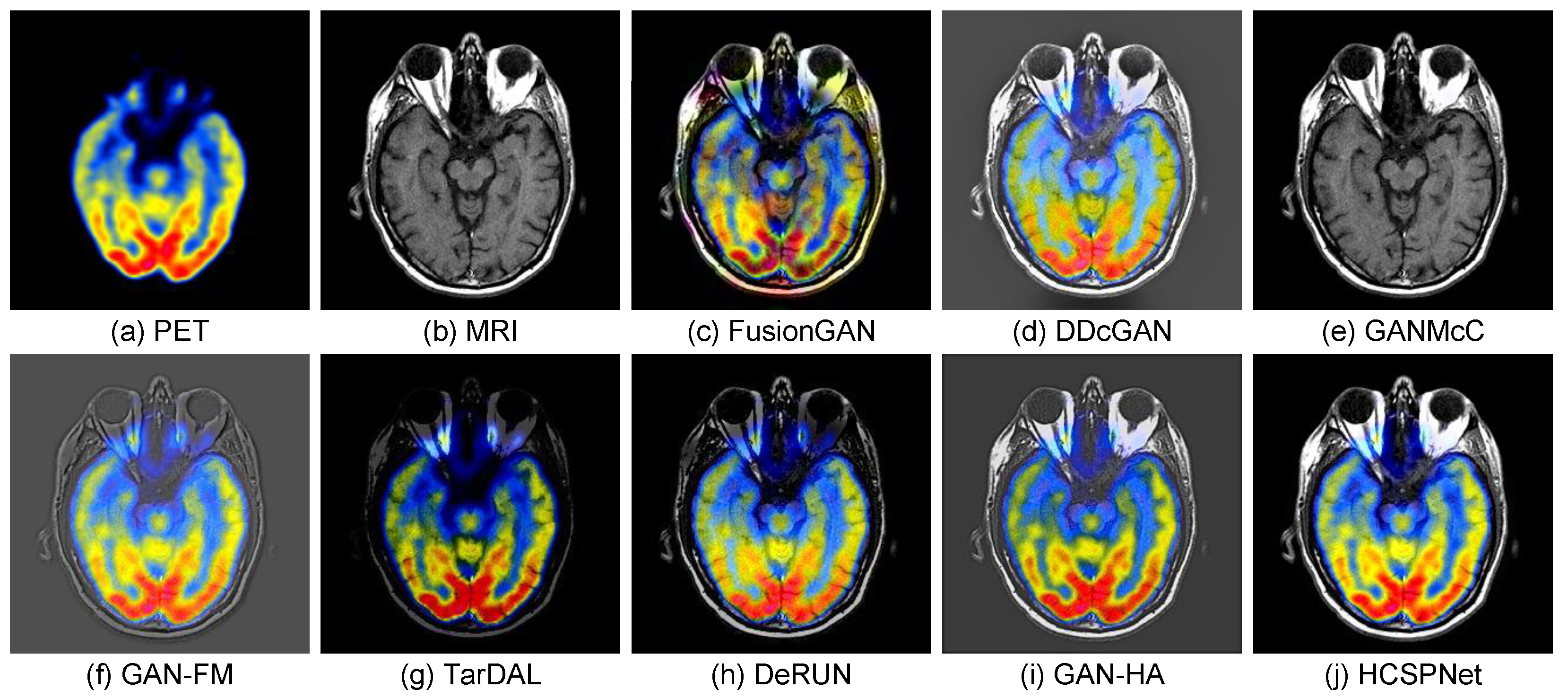 Sensors 25 04658 g008