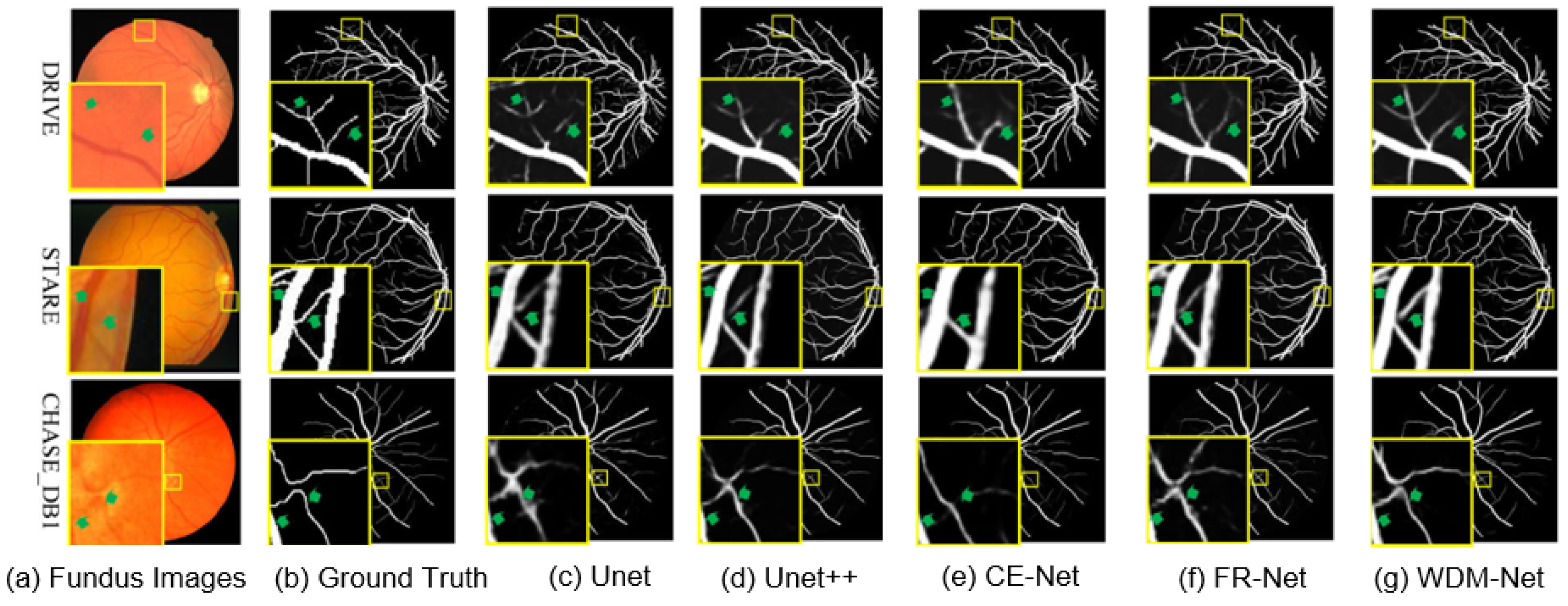 Sensors 25 04840 g006