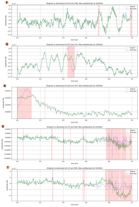 Sensors 25 05018 g0a6b
