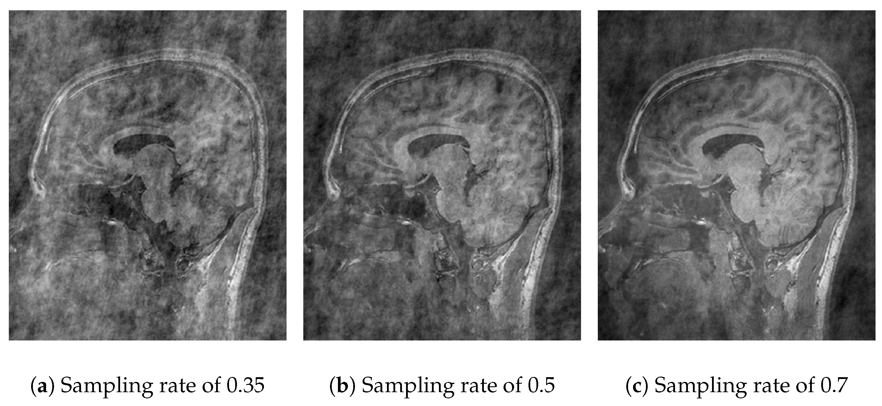 Sensors 25 05137 g005