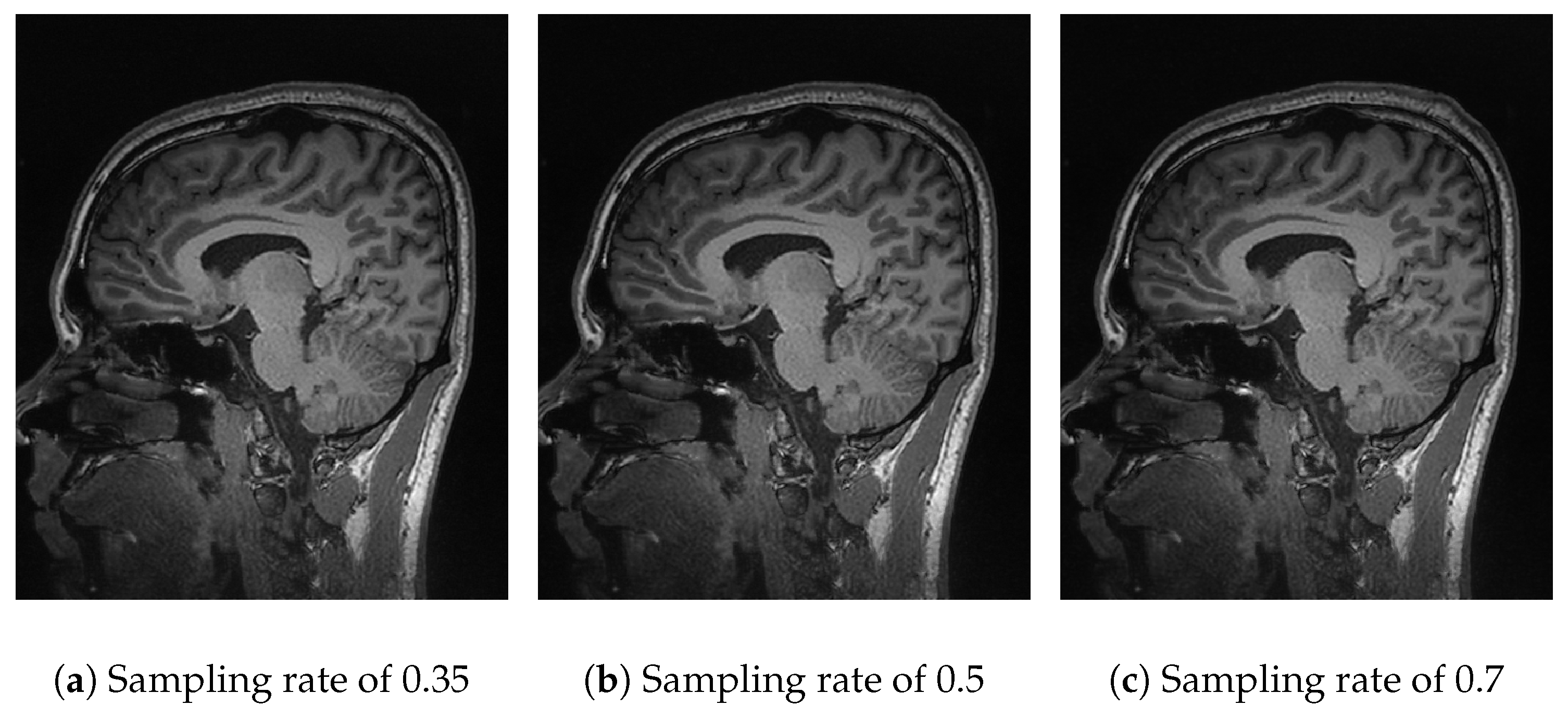 Sensors 25 05137 g006