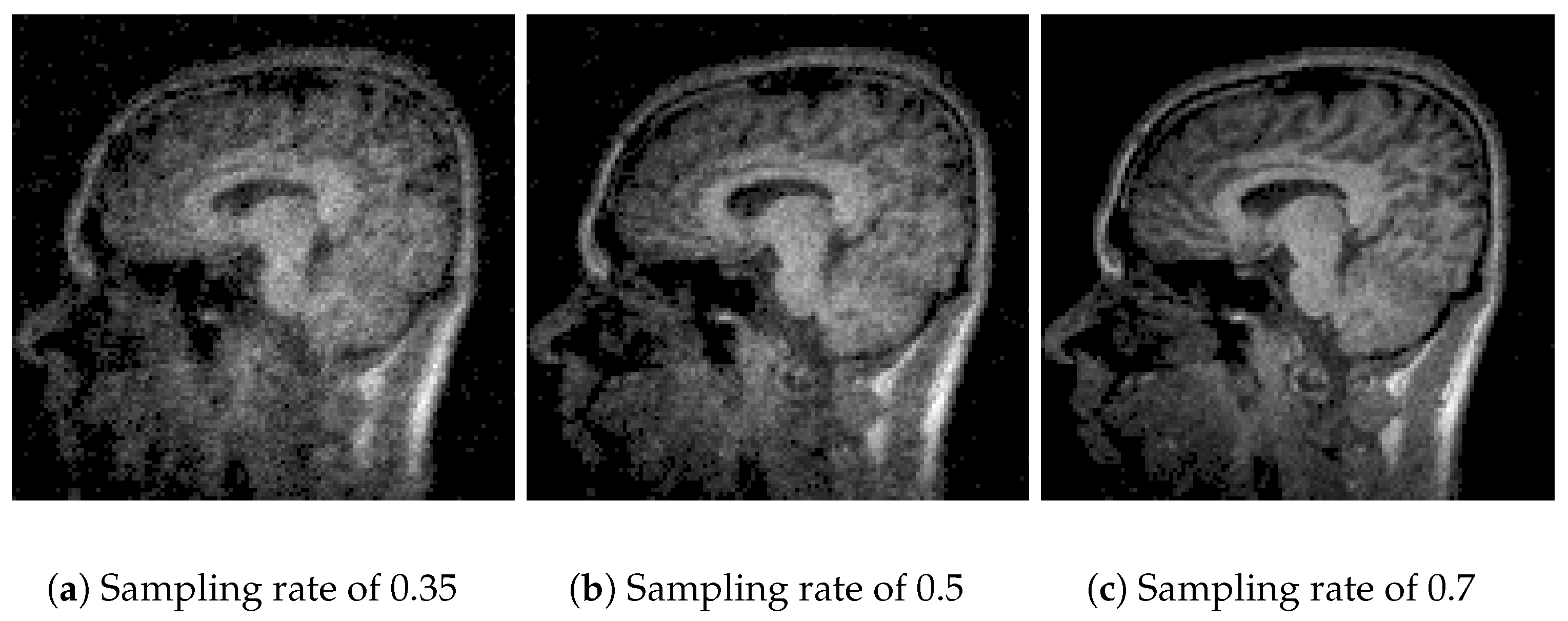 Sensors 25 05137 g007