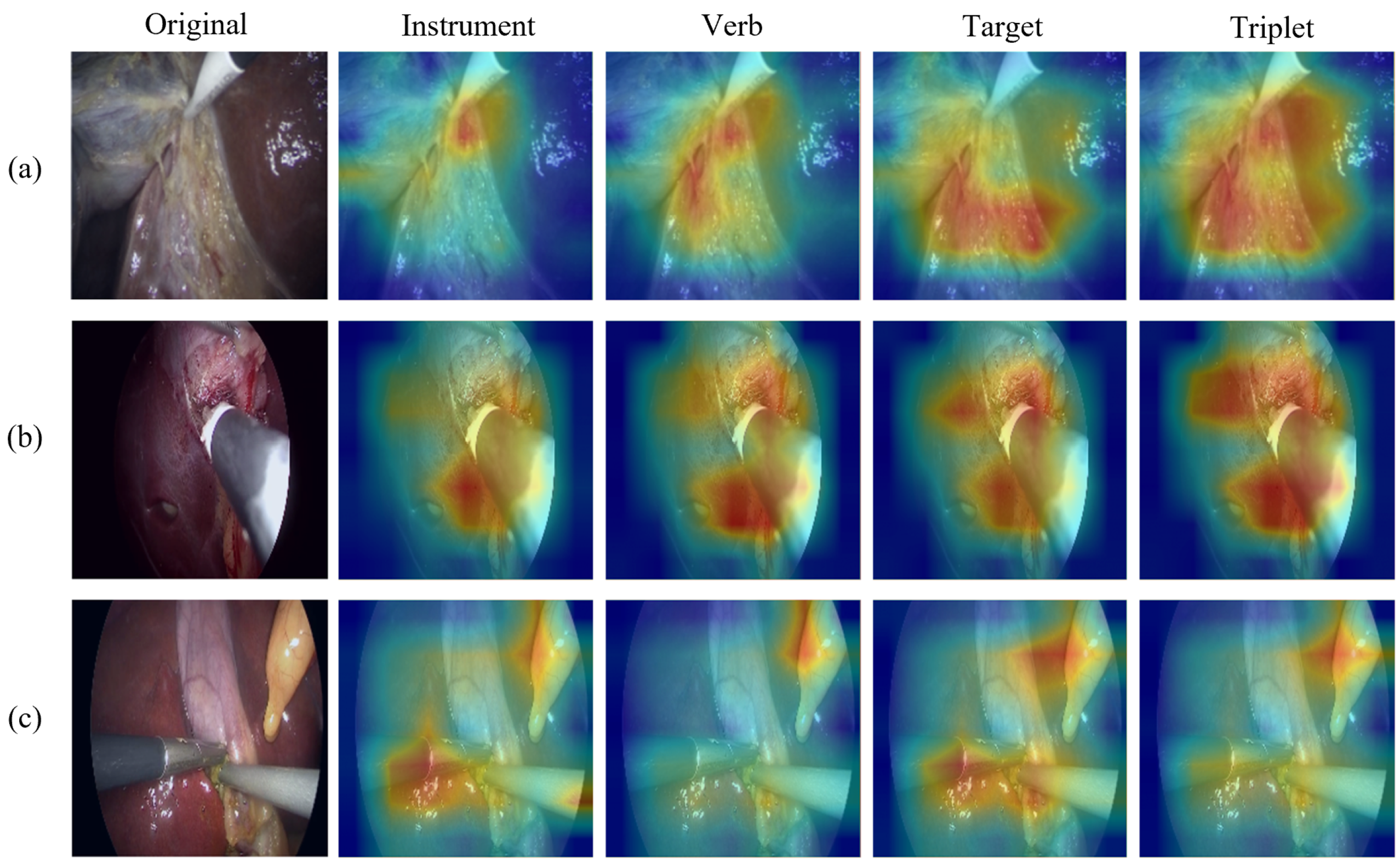 Sensors 25 05306 g005
