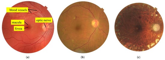 Sensors 25 05658 g001