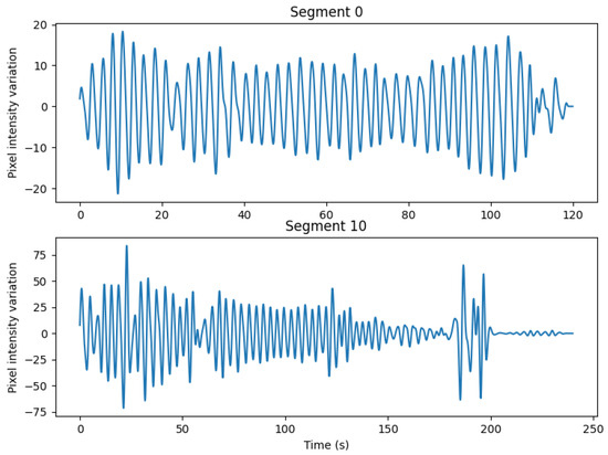 Sensors 25 05956 g0a1
