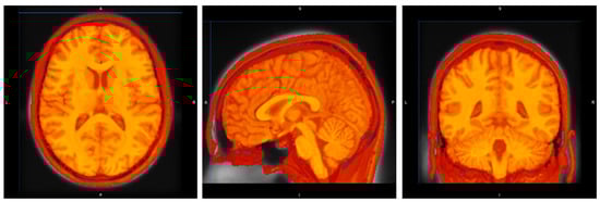 Sensors 25 06009 g0a1