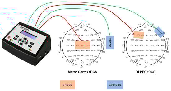 Sensors 25 06241 g002