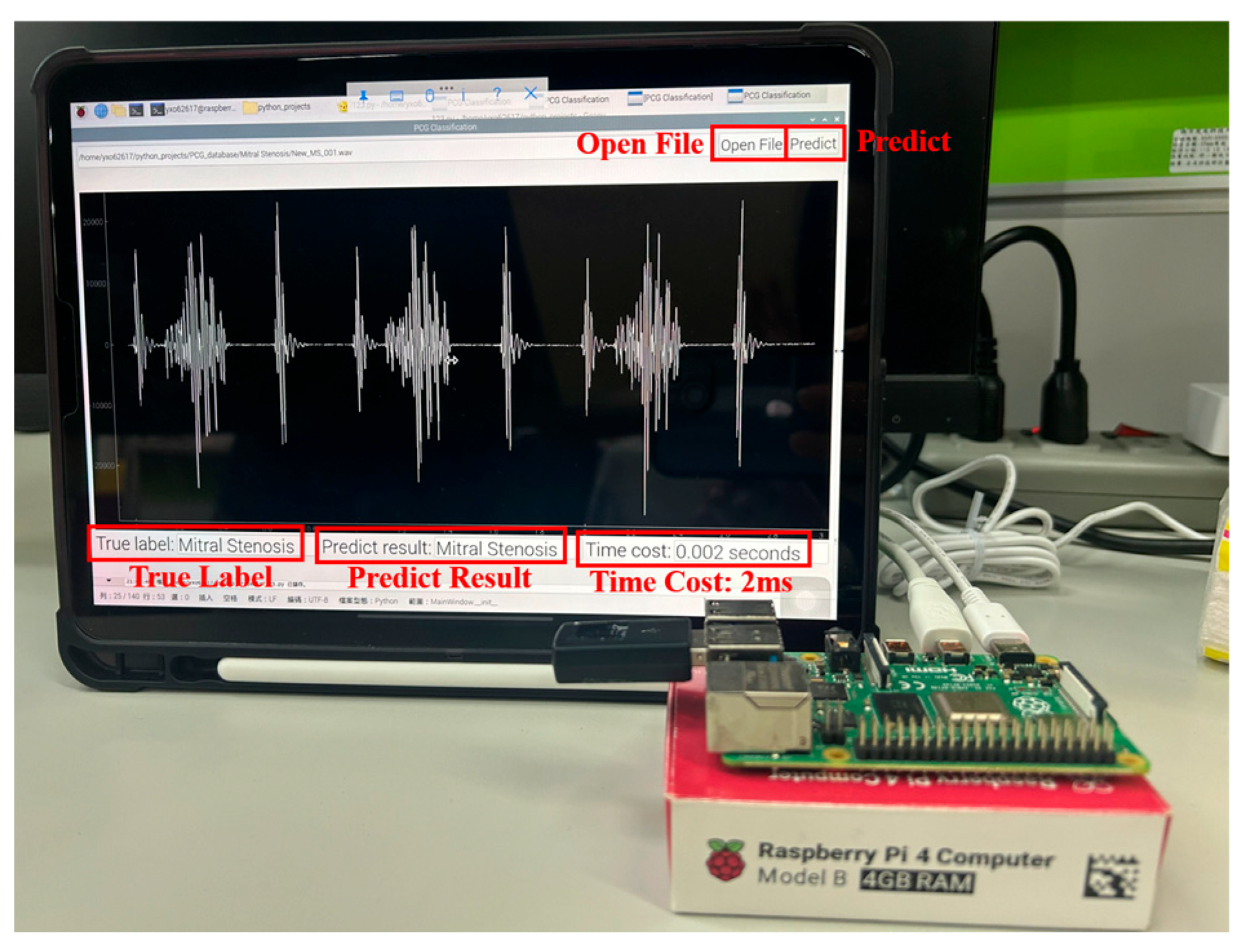 Sensors 25 06562 g018