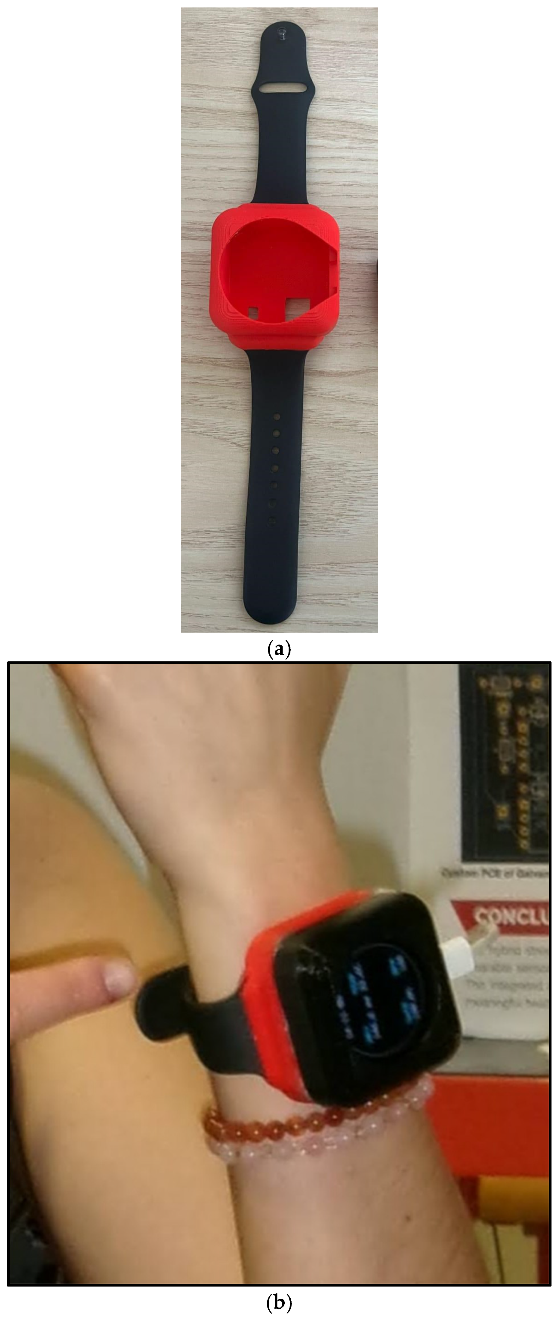 Sensors 25 06592 g004 Sensors 25 06592 g004