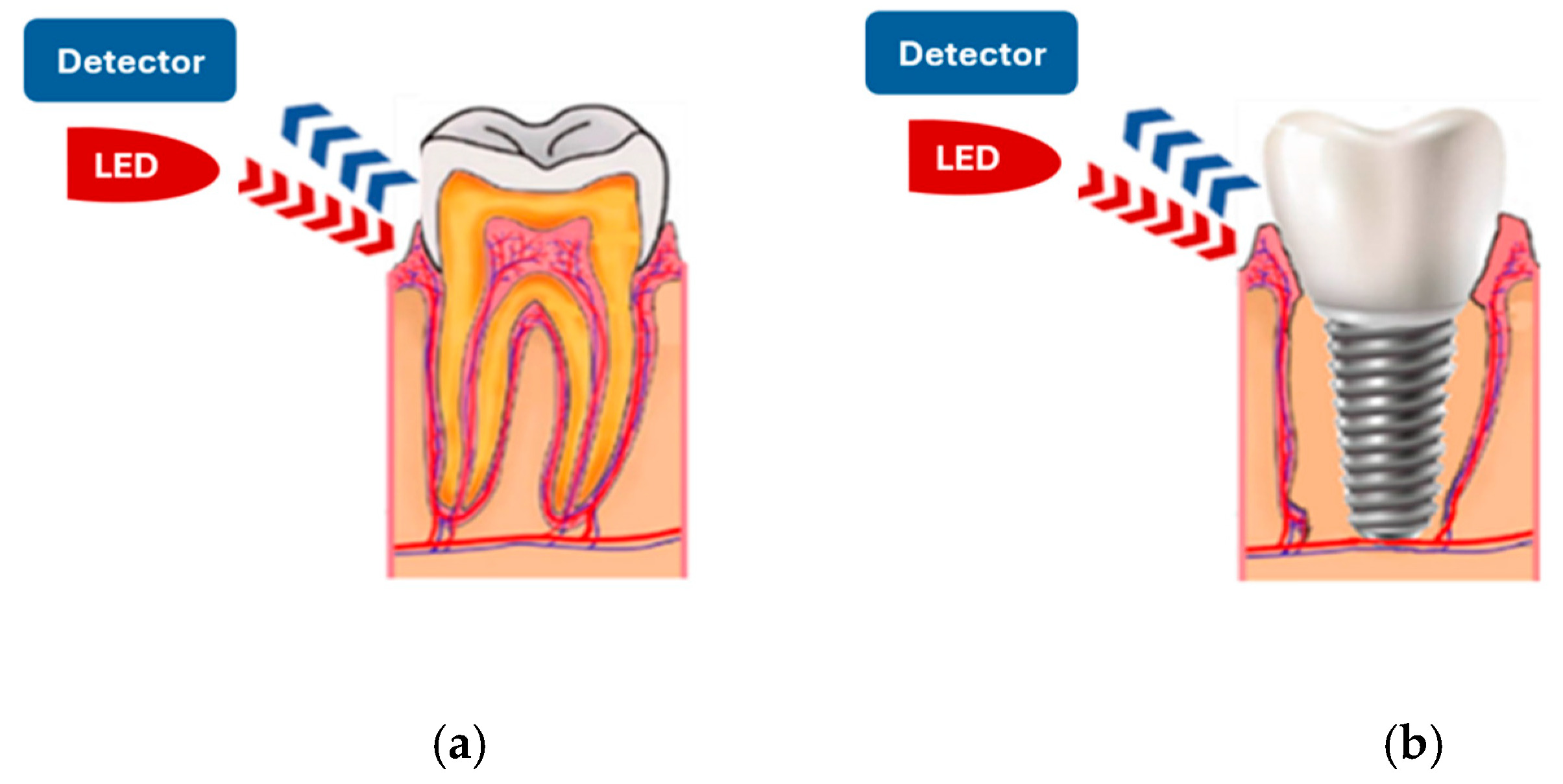 Sensors 25 06604 g002 Sensors 25 06604 g002