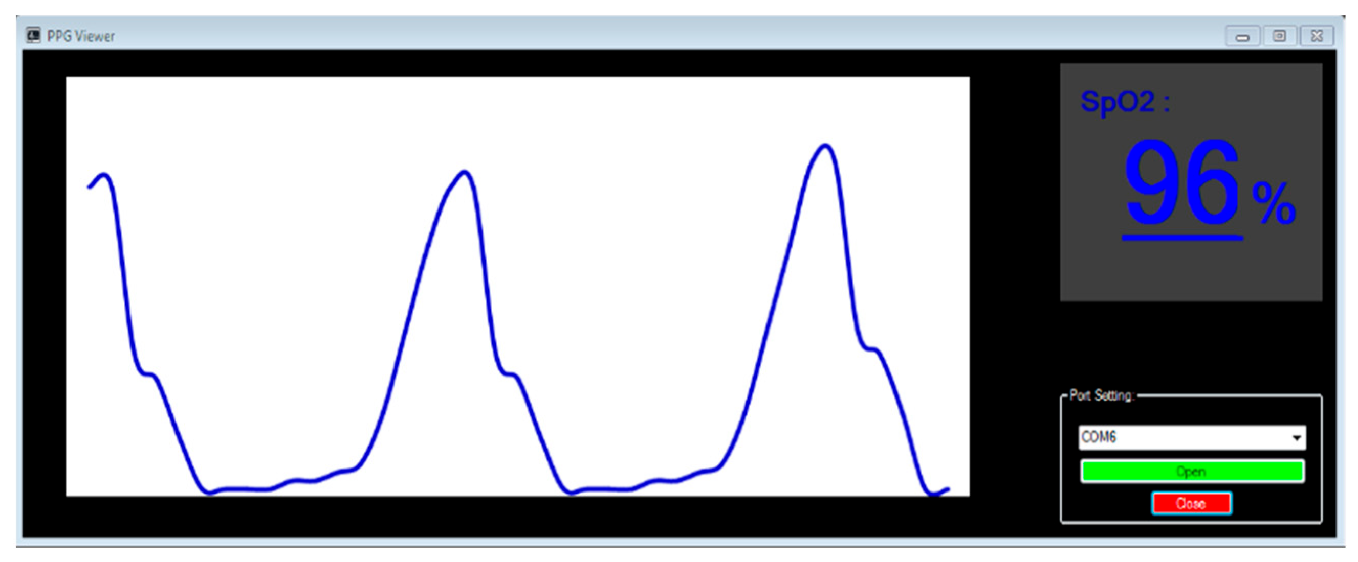 Sensors 25 06604 g006 Sensors 25 06604 g006