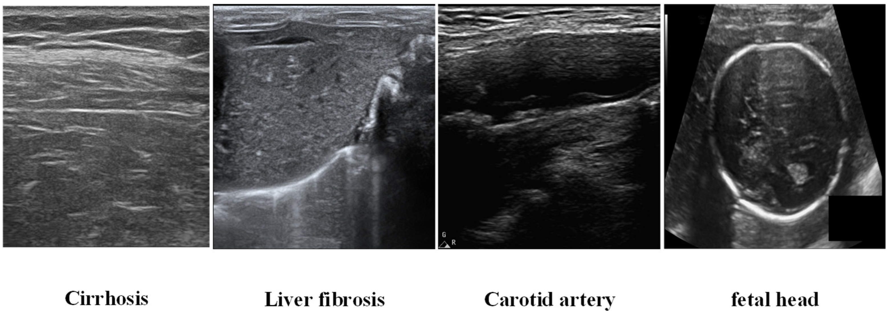 Sensors 25 06694 g004