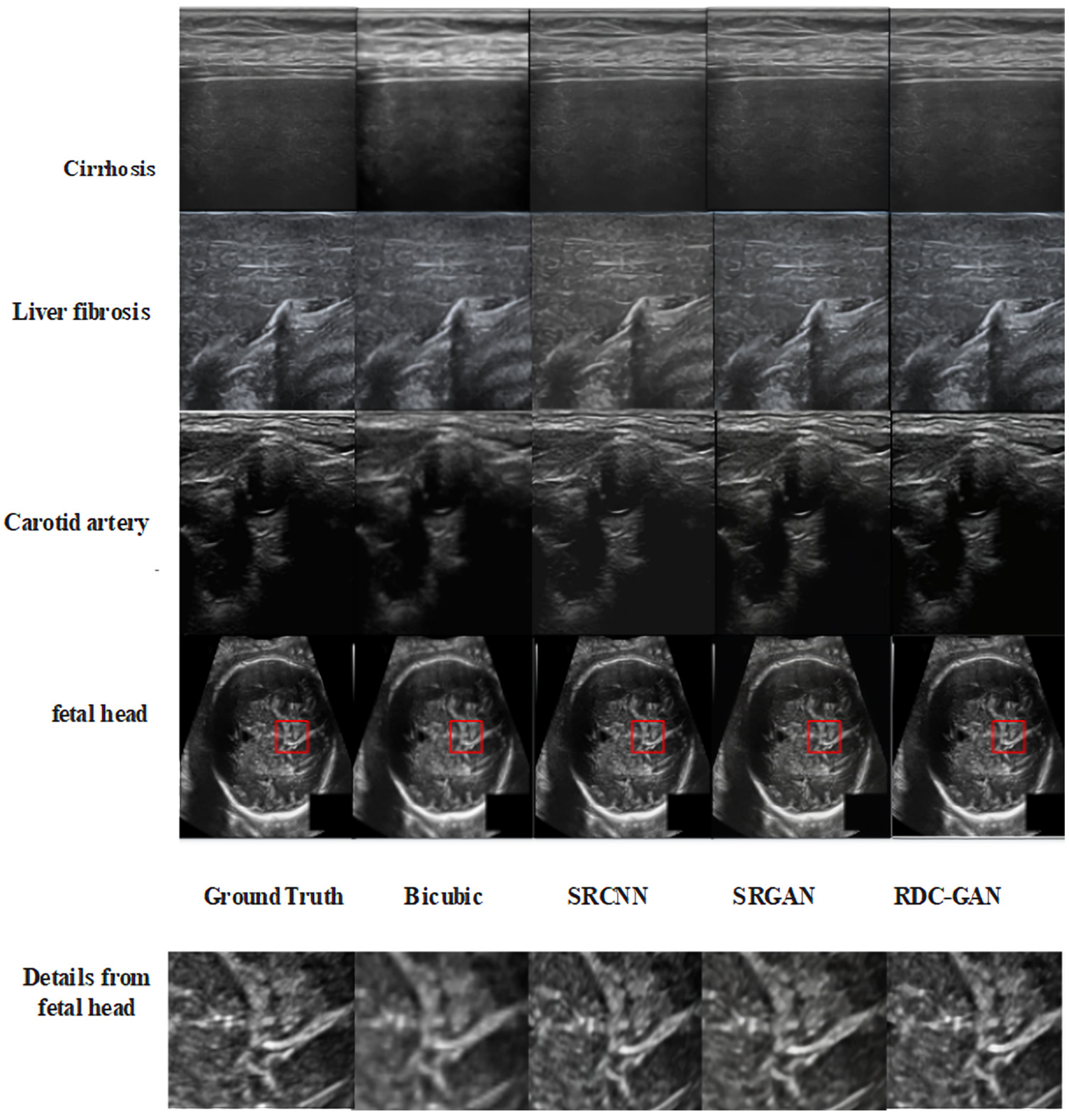 Sensors 25 06694 g005