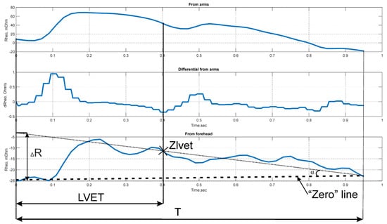 Sensors 25 07190 g0a1