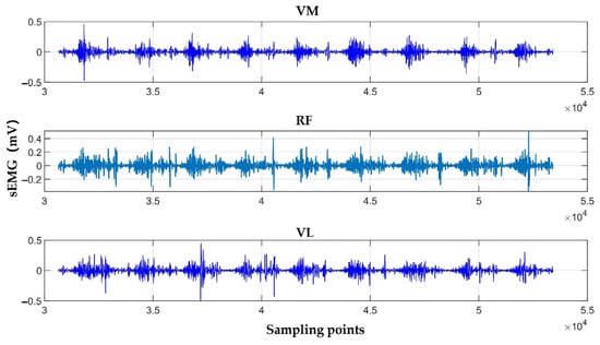 sEMG waveforms of the VM, VL, and RF muscles.