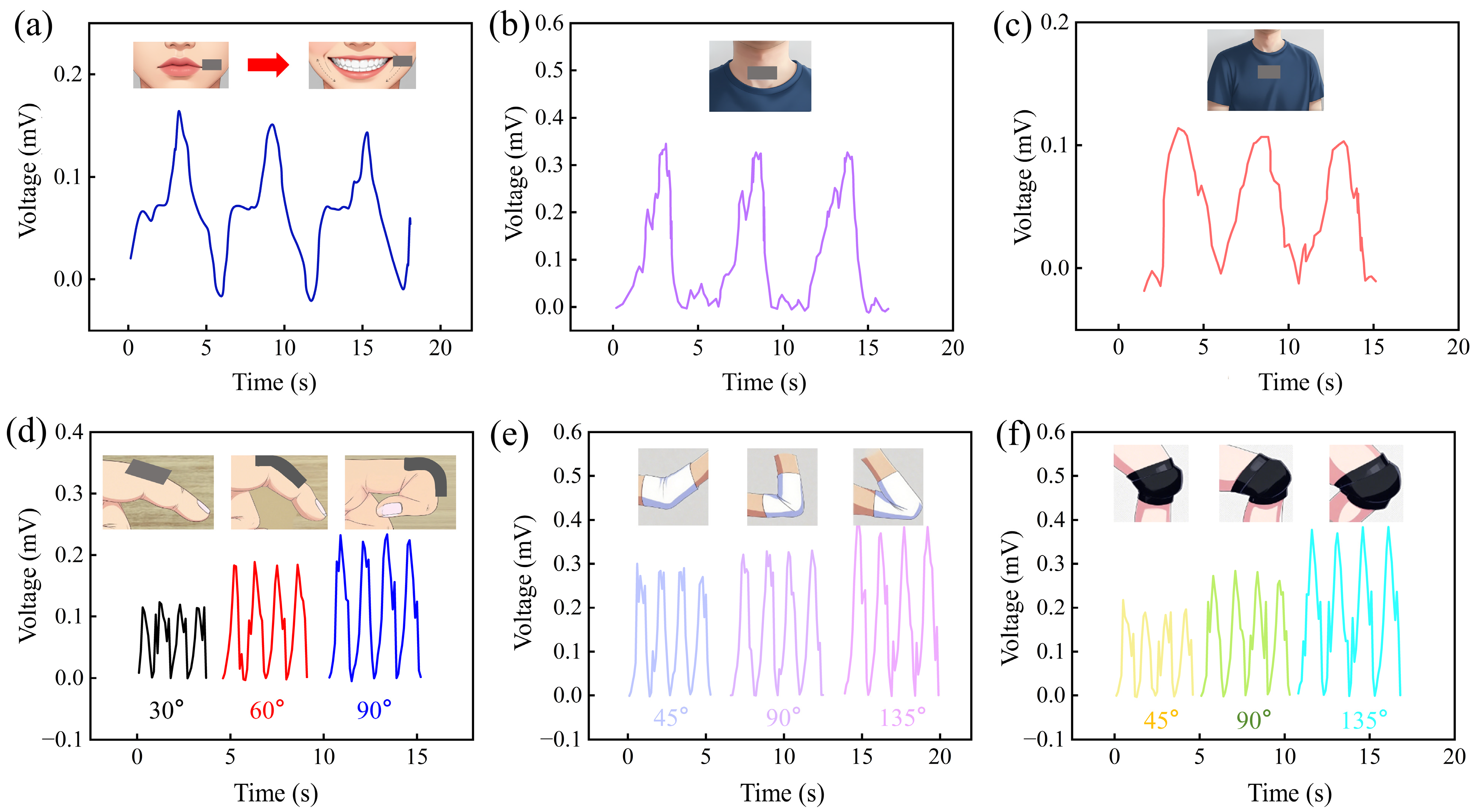 Sensors 26 00394 g011